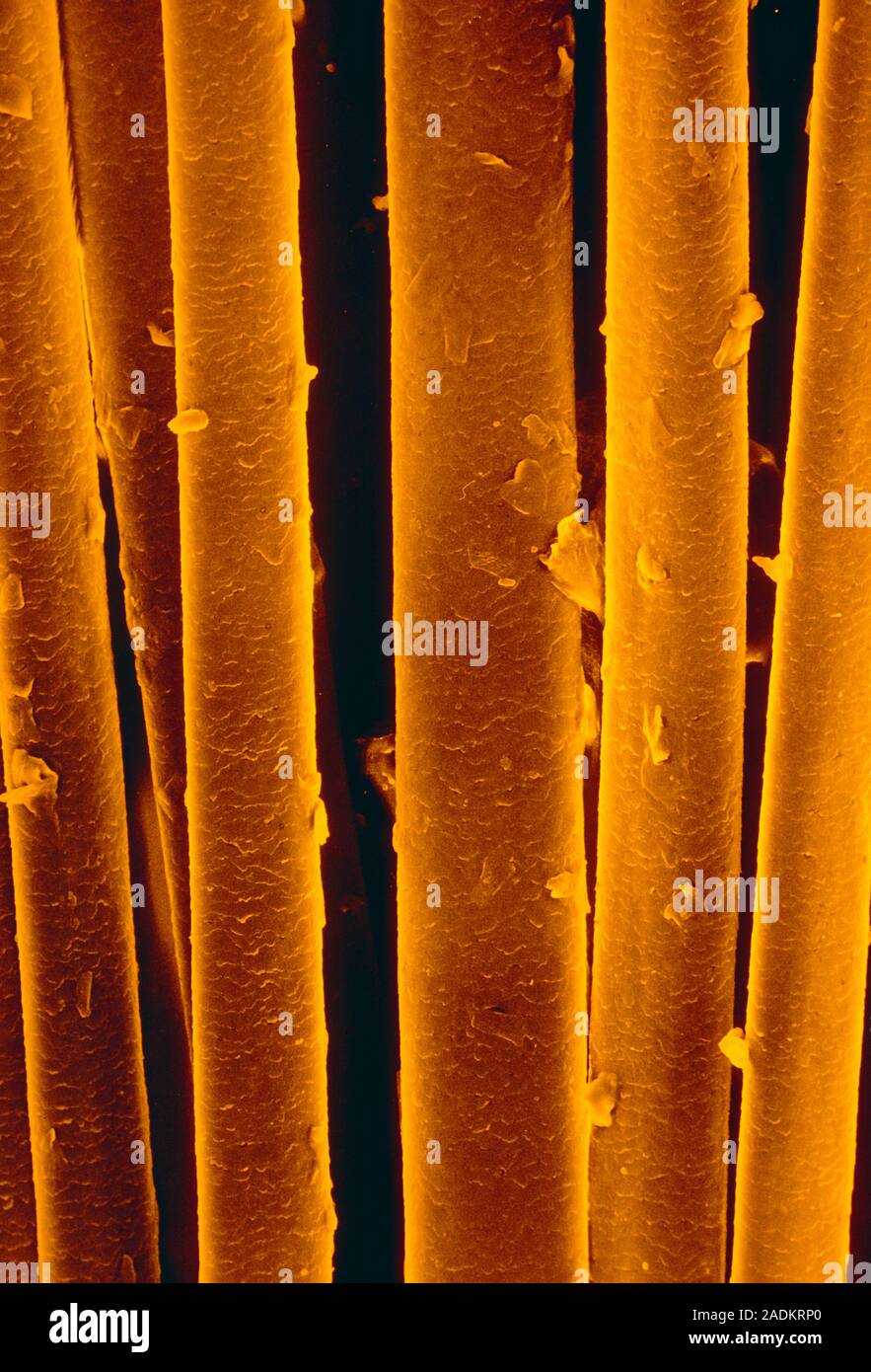 False colour scanning electron micrograph (SEM) of dirty human hair ...