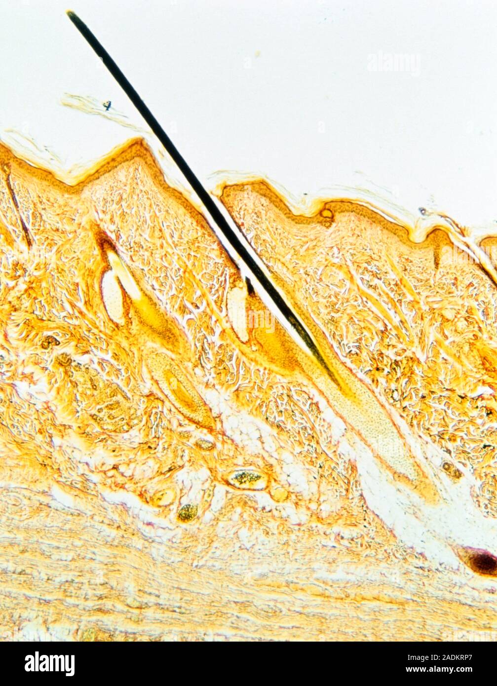 Light micrograph of a section of human skin, with a single hair. The