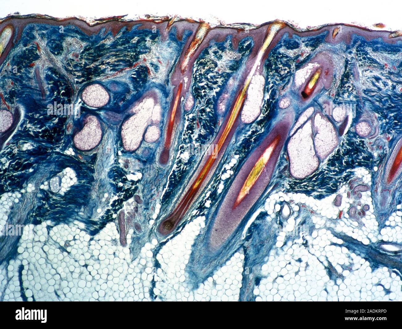 Light micrograph of a section of human skin, showing three central hair ...