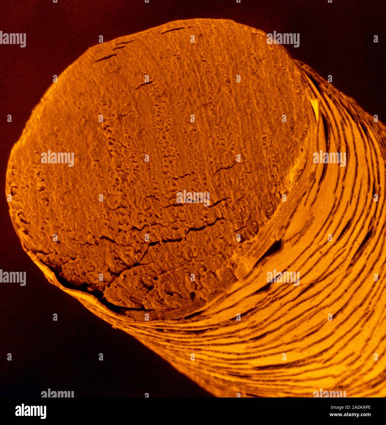 False-colour scanning electron micrograph (SEM) of a single human hair ...