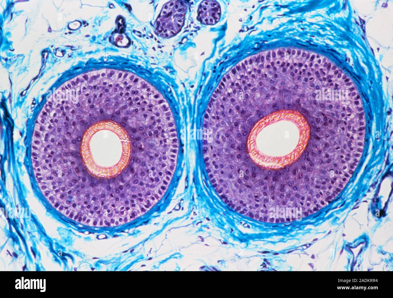 Hair. Light micrograph of a cross-section through hairs of the human ...