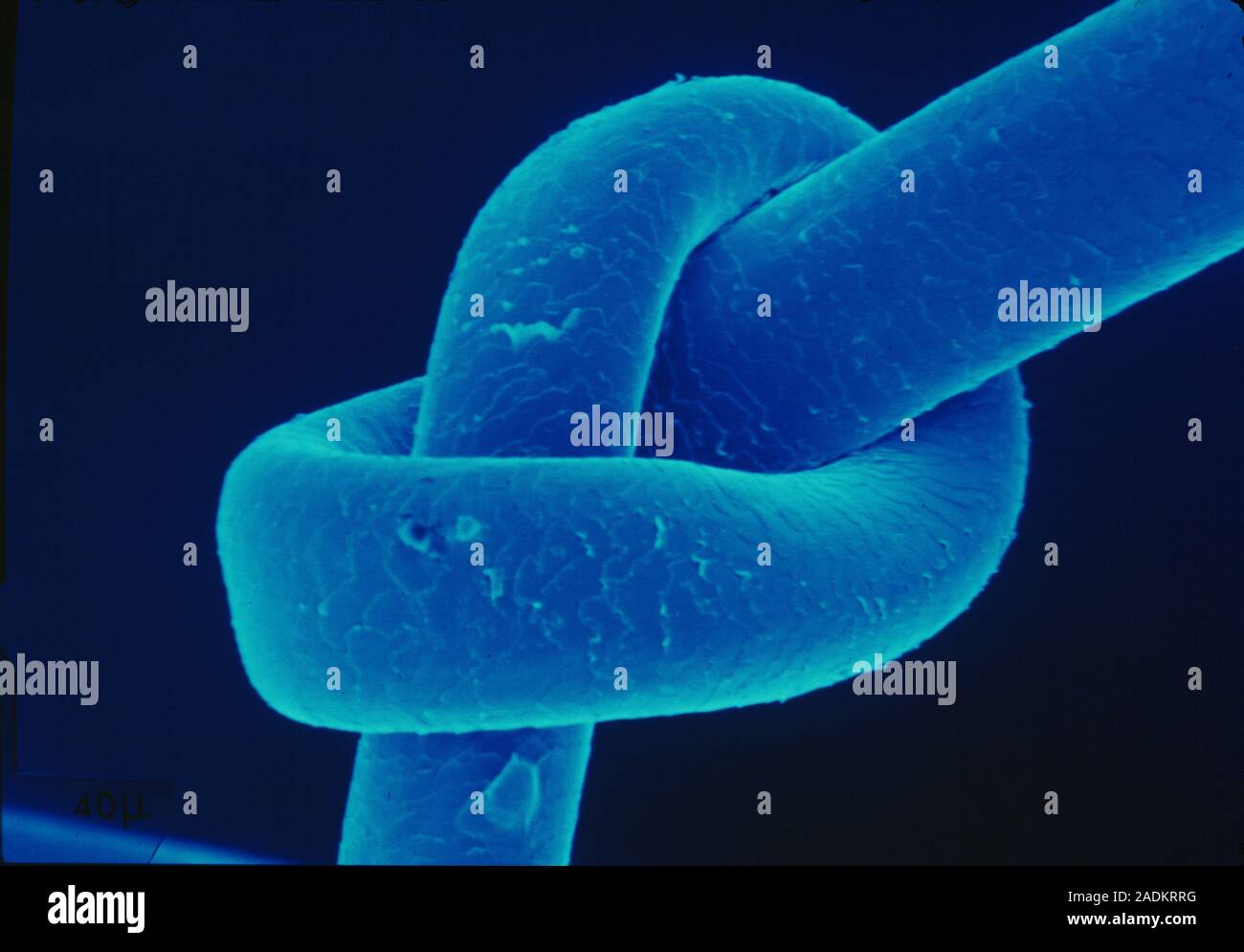 Knotted hair. Colour scanning electron micrograph (SEM) of a knotted