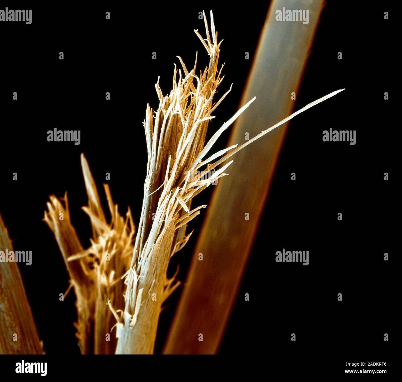 Split hair. Coloured scanning electron micrograph (SEM) of a split