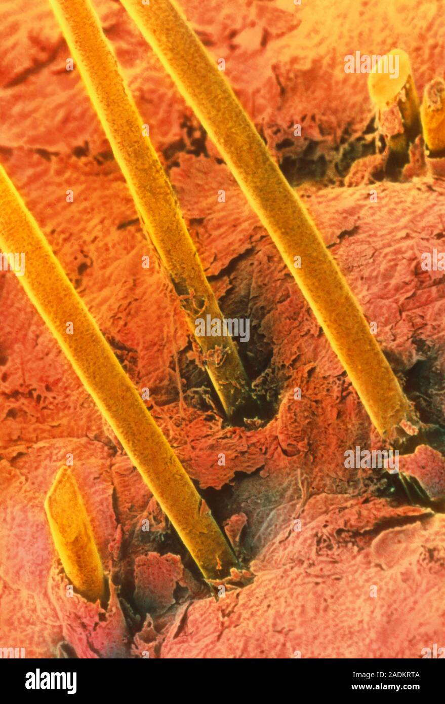 Волос под микроскопом, потерявший плотность