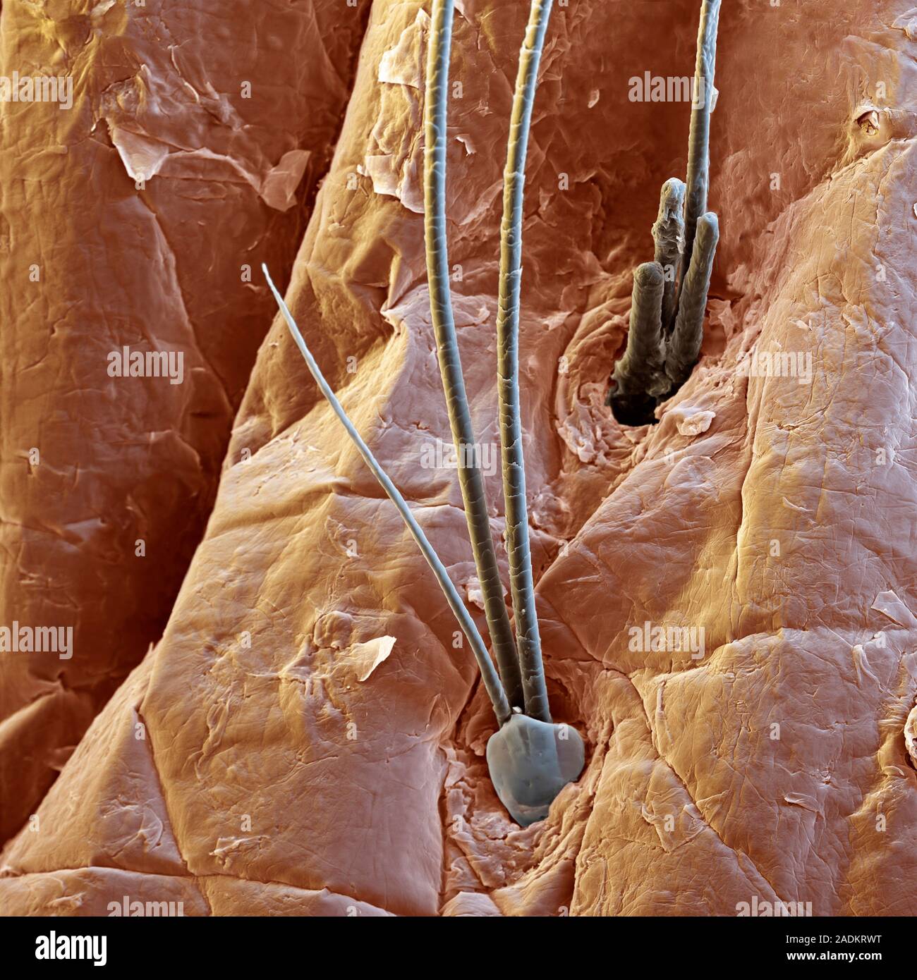 Hairs on a skin mole. Coloured scanning electron micrograph (SEM) of