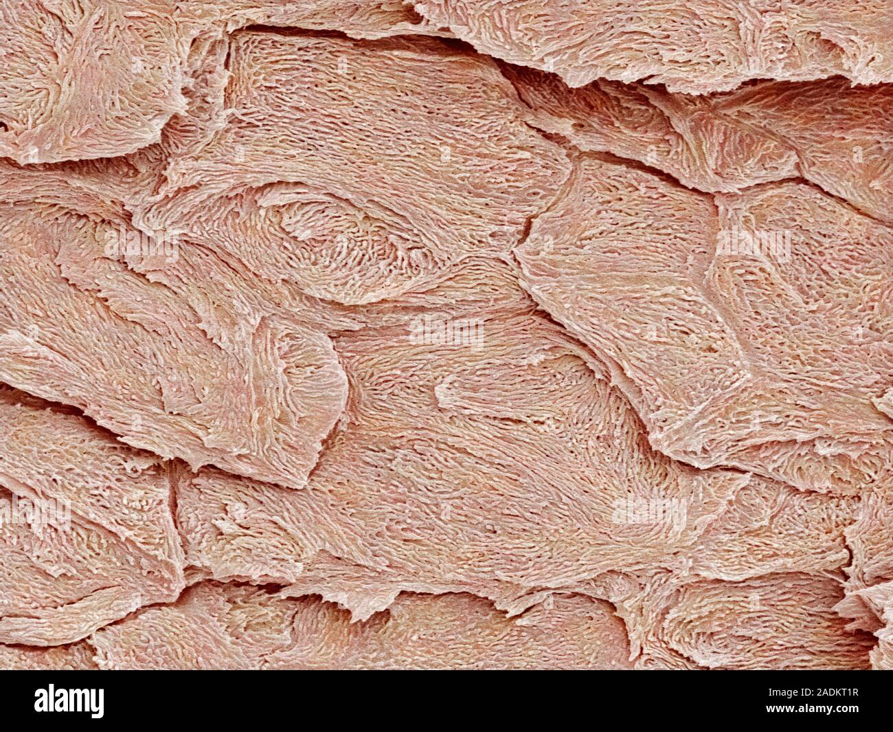 Nail keratin layers. Coloured scanning electron micrograph (SEM) of