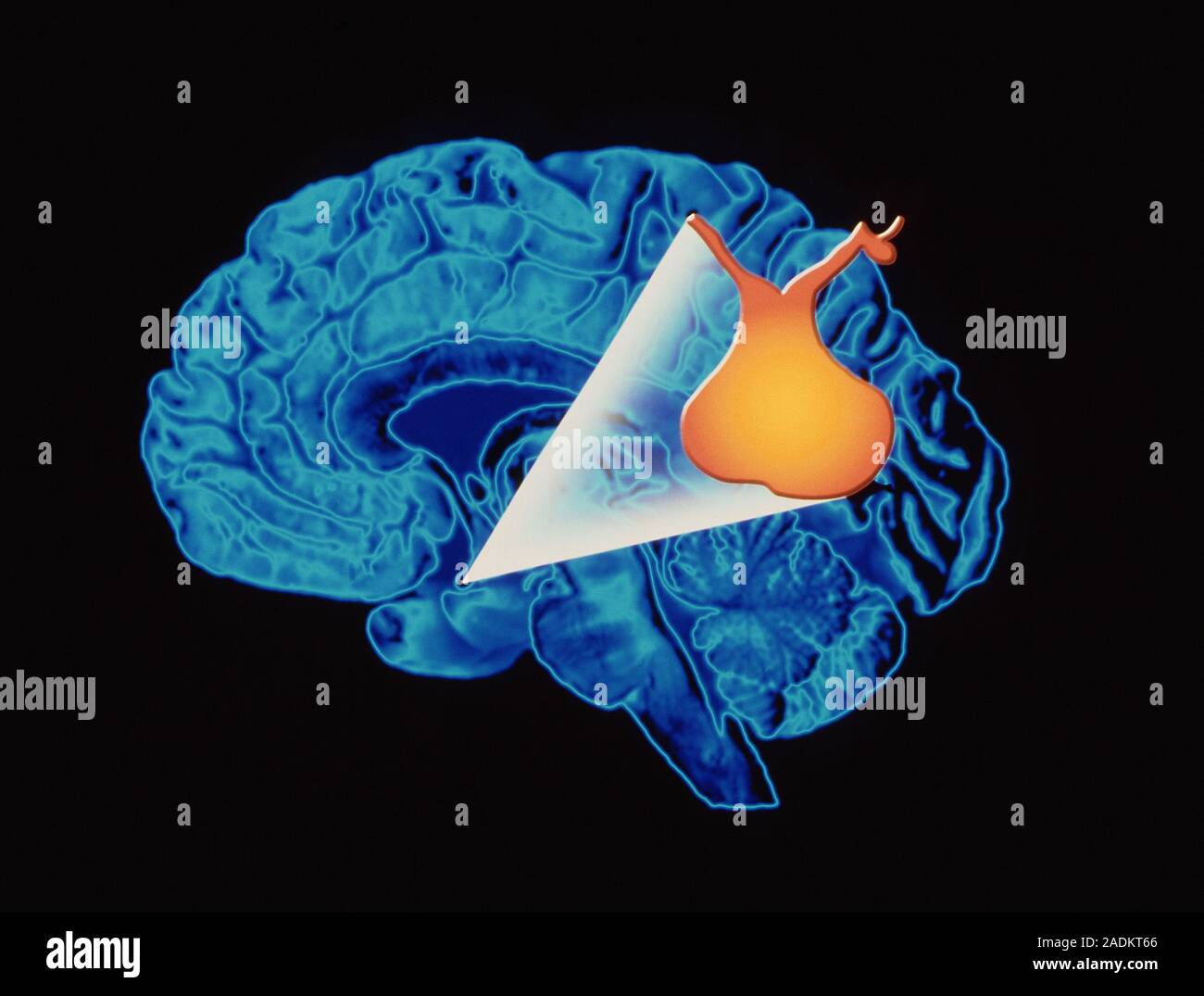 Pituitary gland. Computer artwork depicting the location of the