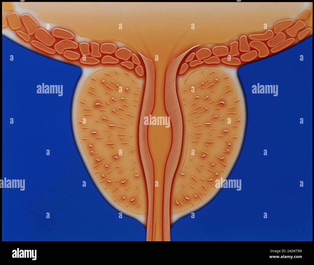 Prostate visual data 5