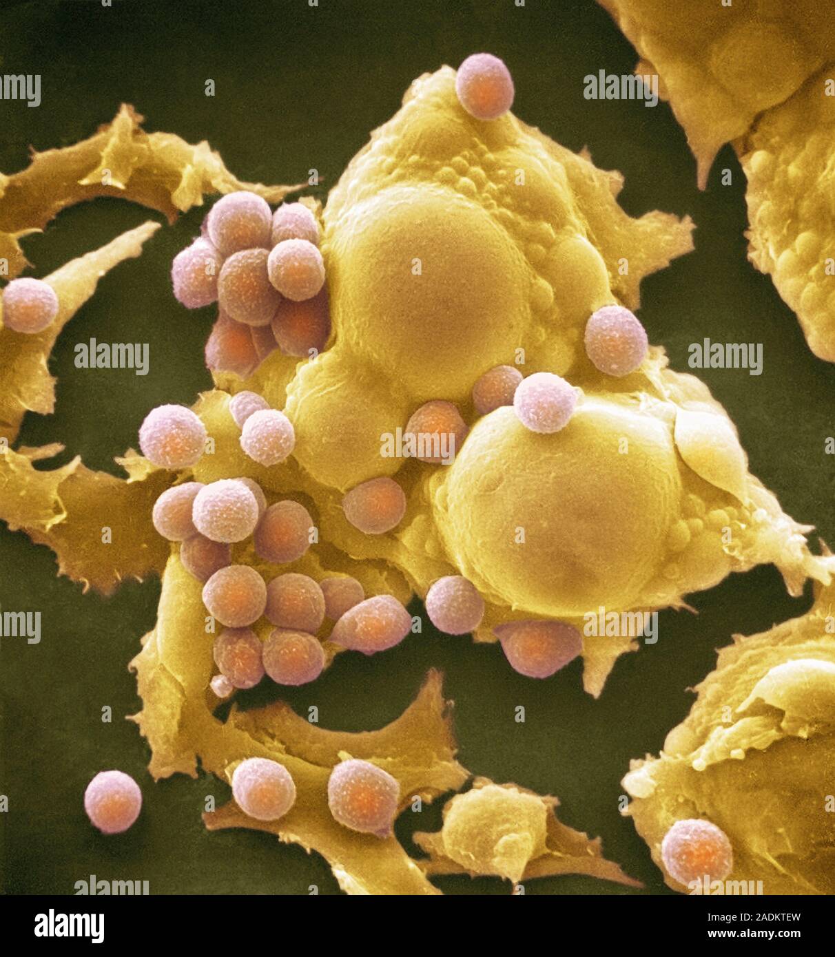Адипоциты гистология. Жировые клетки человека под микроскопом. Стволовая клетка жировой ткани. Стволовые клетки из костного мозга. Дифференцировка адипоцитов.