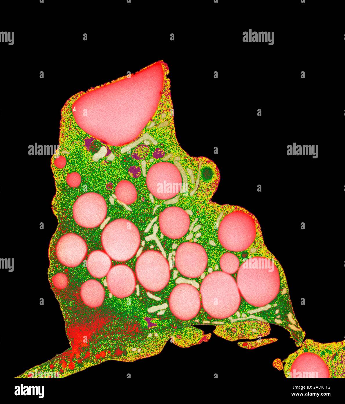 Fat cells. Coloured transmission electron micrograph (TEM) of a section ...