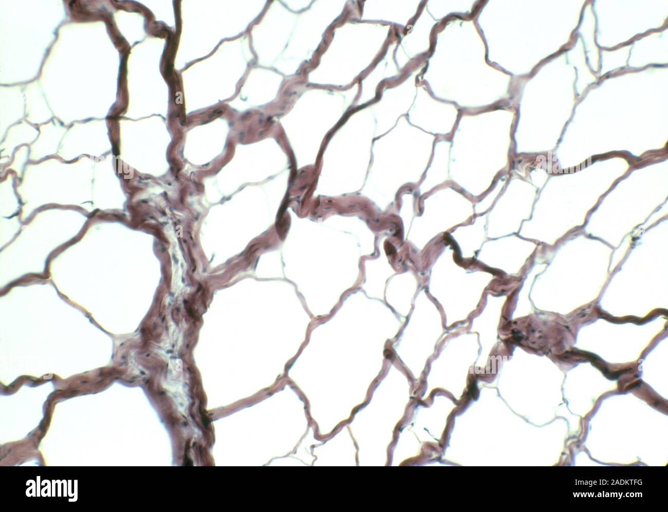 Connective tissue. Light micrograph of a network of connective tissue
