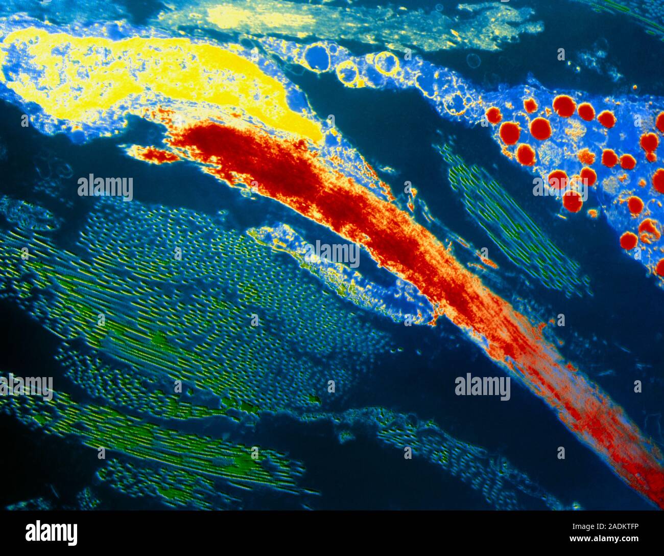 Elastin. Coloured transmission electron micrograph (TEM) of an elastin