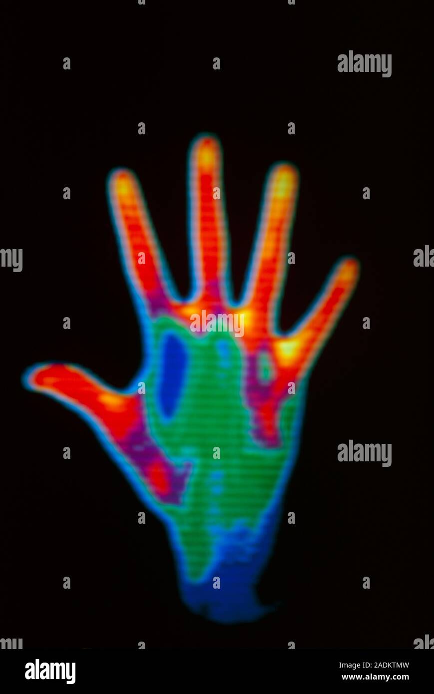 Thermograph (heat image) of a man's hand, showing palm upward. The