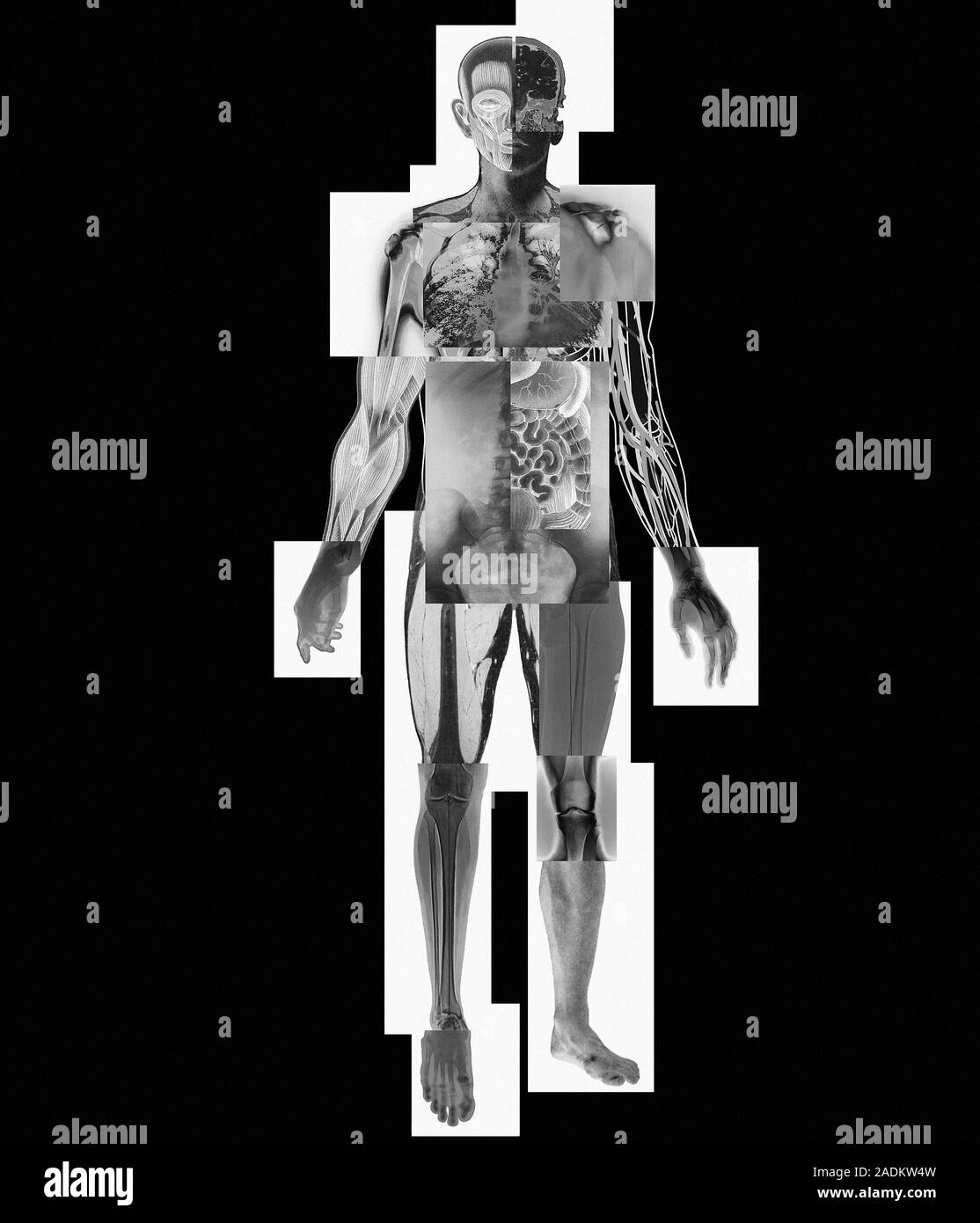 Body imaging. Composite image of several methods used to visualise the