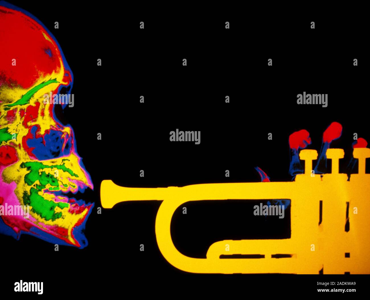 Skull with trumpet. Coloured Xray of a human skull (side view