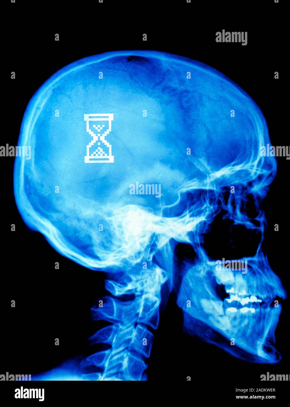 Thinking. Conceptual image of a computer hourglass icon seen inside a ...
