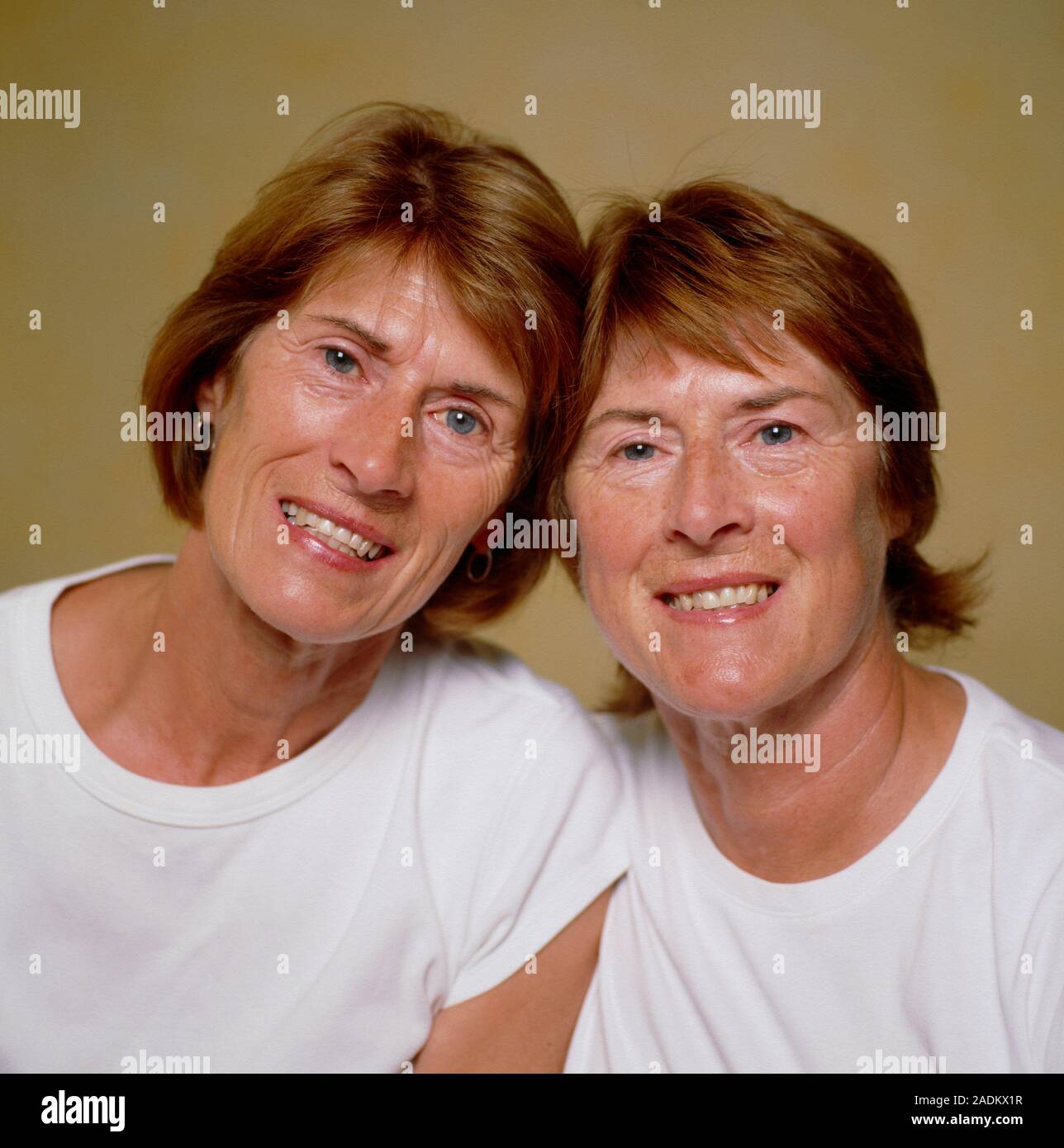 MODEL RELEASED. Identical twin sisters. Identical twins occur when a