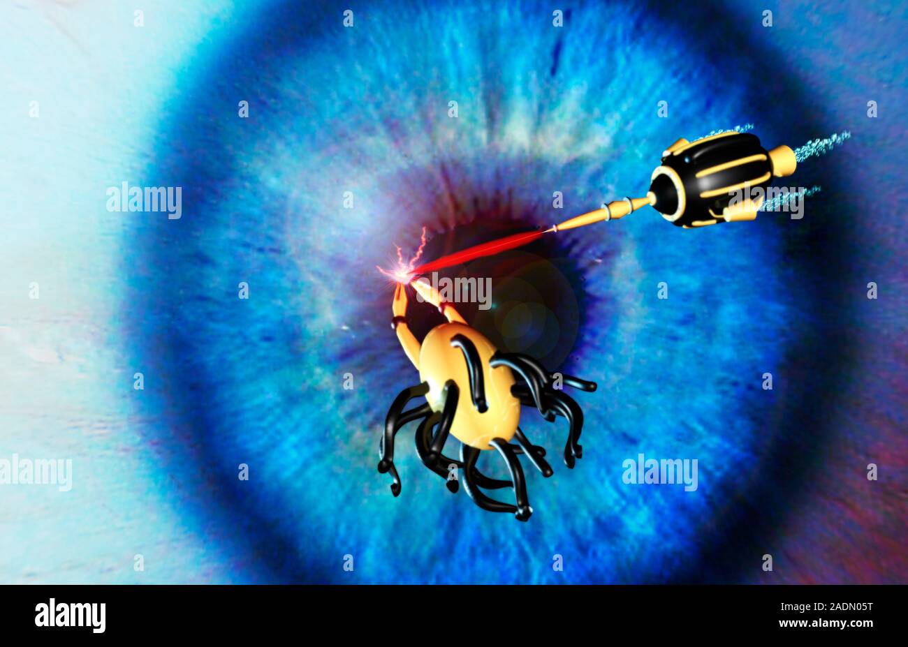 Nanorobots. Computer artwork of nanorobots operating on the eye using ...