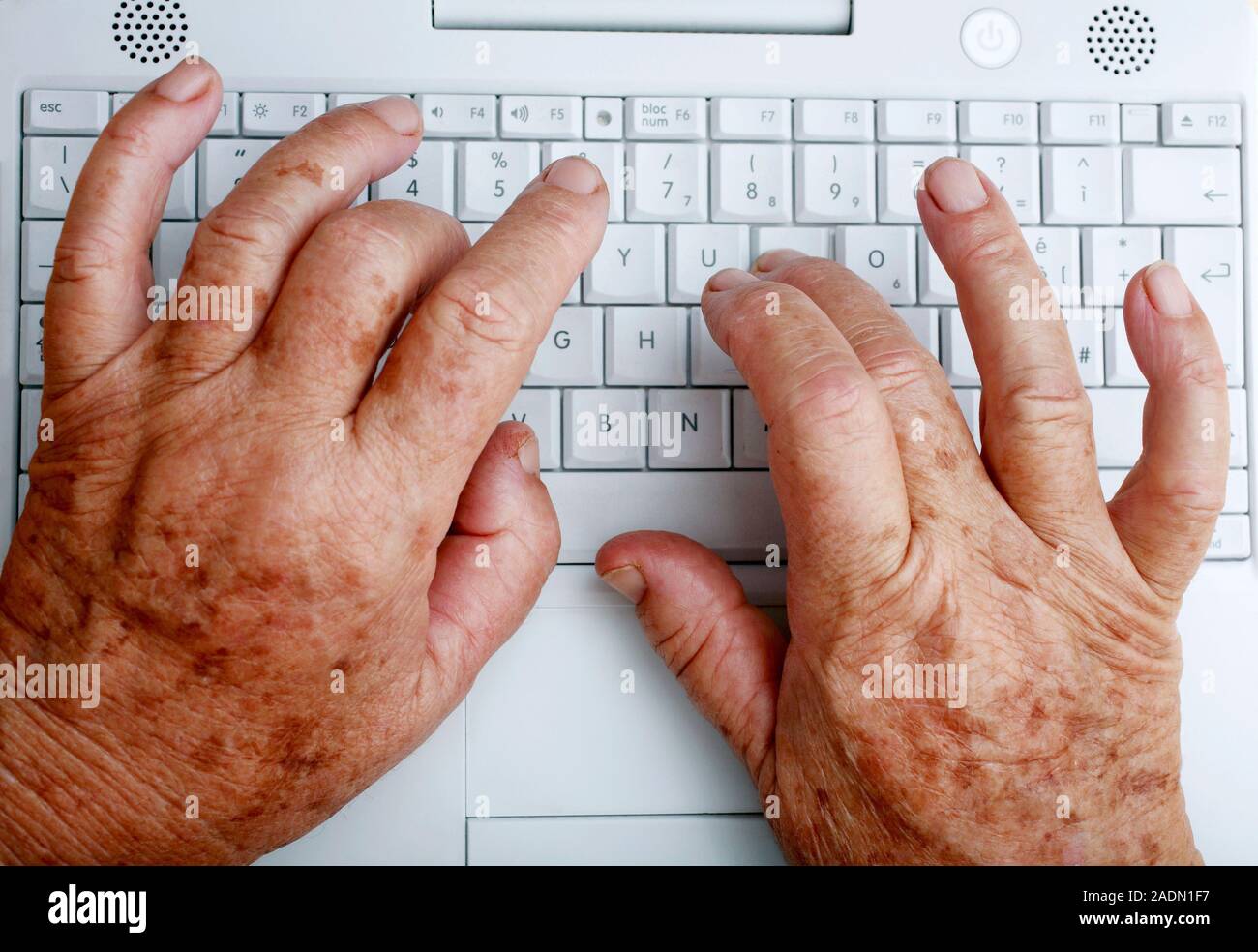 Keyboard use. Elderly woman typing on a laptop keyboard. Stock Photo