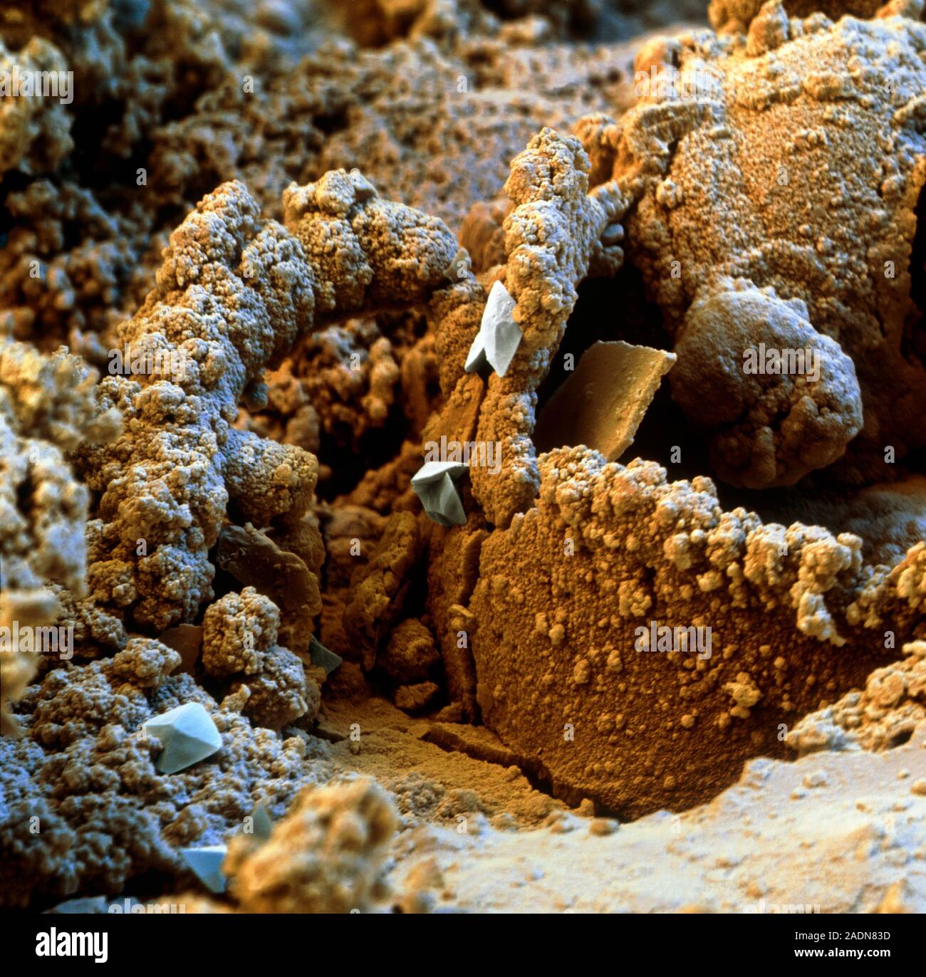 microscope of fingernails｜TikTok Search