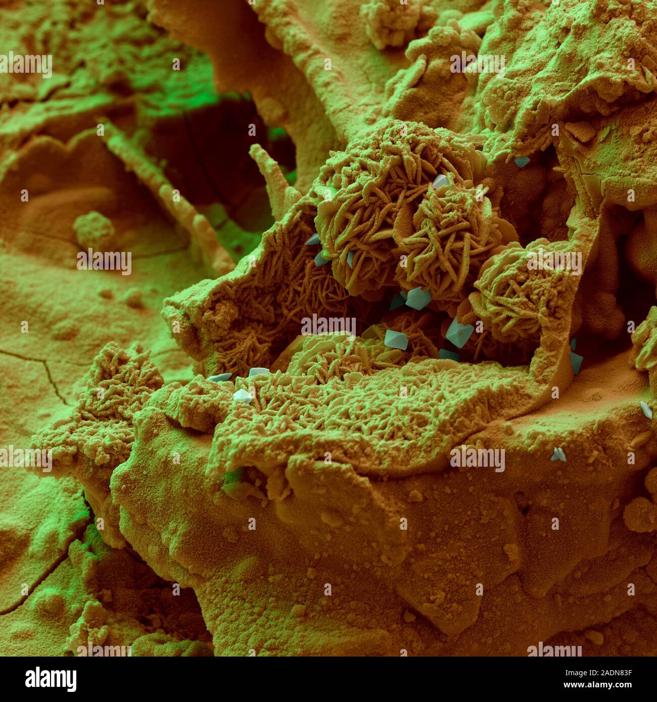 Rusty nail surface. Coloured scanning electron micrograph (SEM) of the corroded surface of a rusty metal nail. Corrosion is the destruction of the met Stock Photo