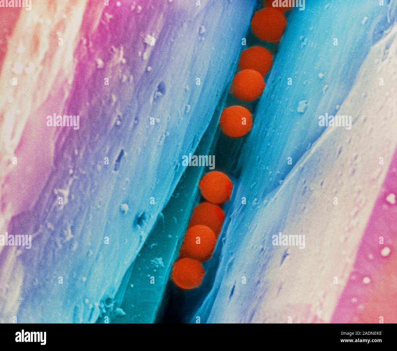 DNA security beads. Coloured scanning electron micrograph (SEM) of CypherMark DNA (deoxyribonucl- eic acid) security beads in the crevice of a diamond Stock Photo