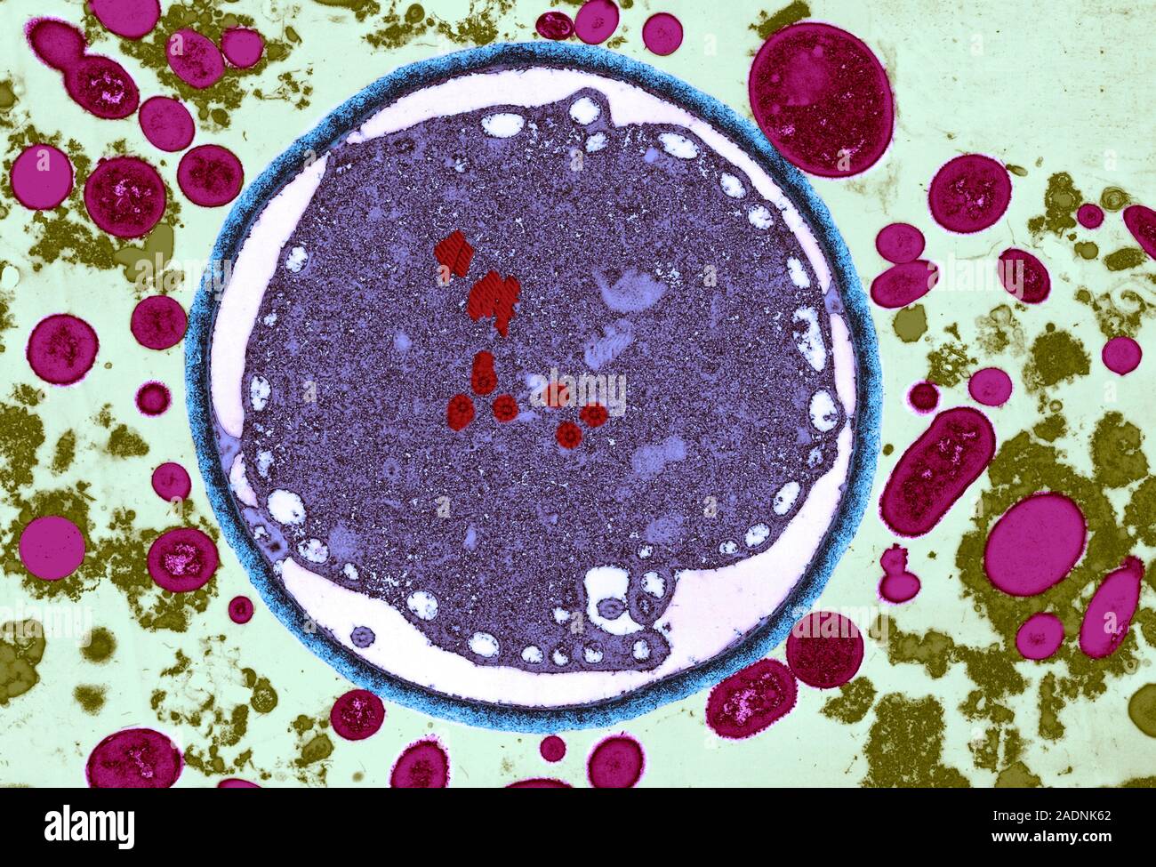 Giardia lamblia protozoan. Coloured transmission electron micrograph