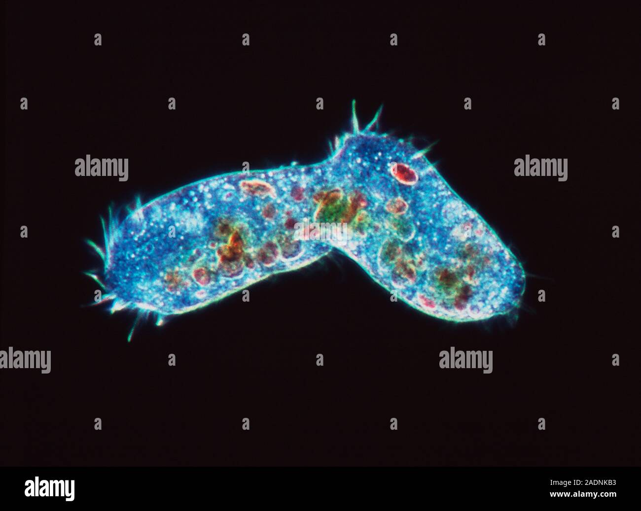 Ciliate protozoa. Light micrograph of unidentified ciliate protozoa ...