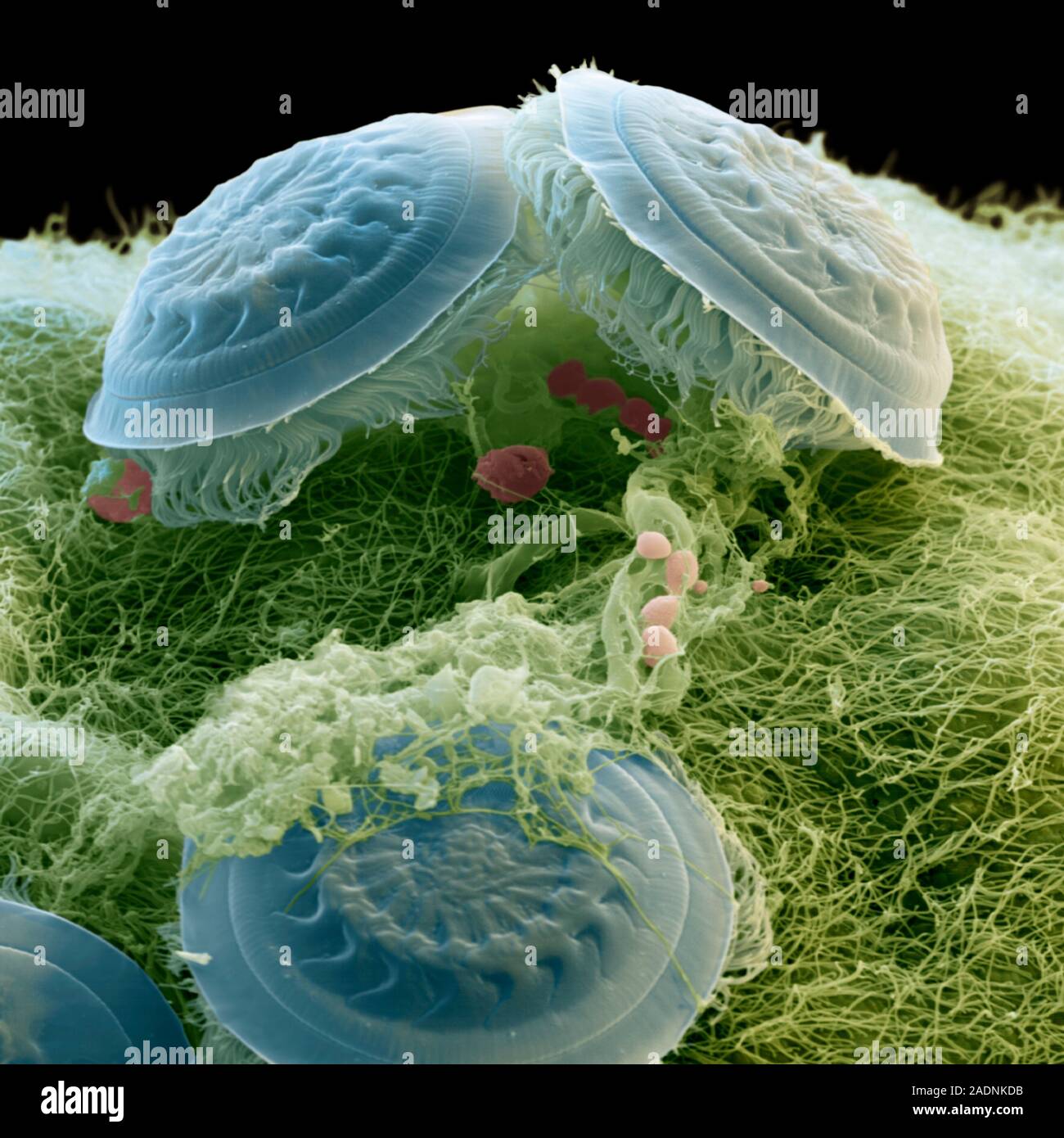 Fish ectoparasite Trichodina sp., coloured scanning electron micrograph