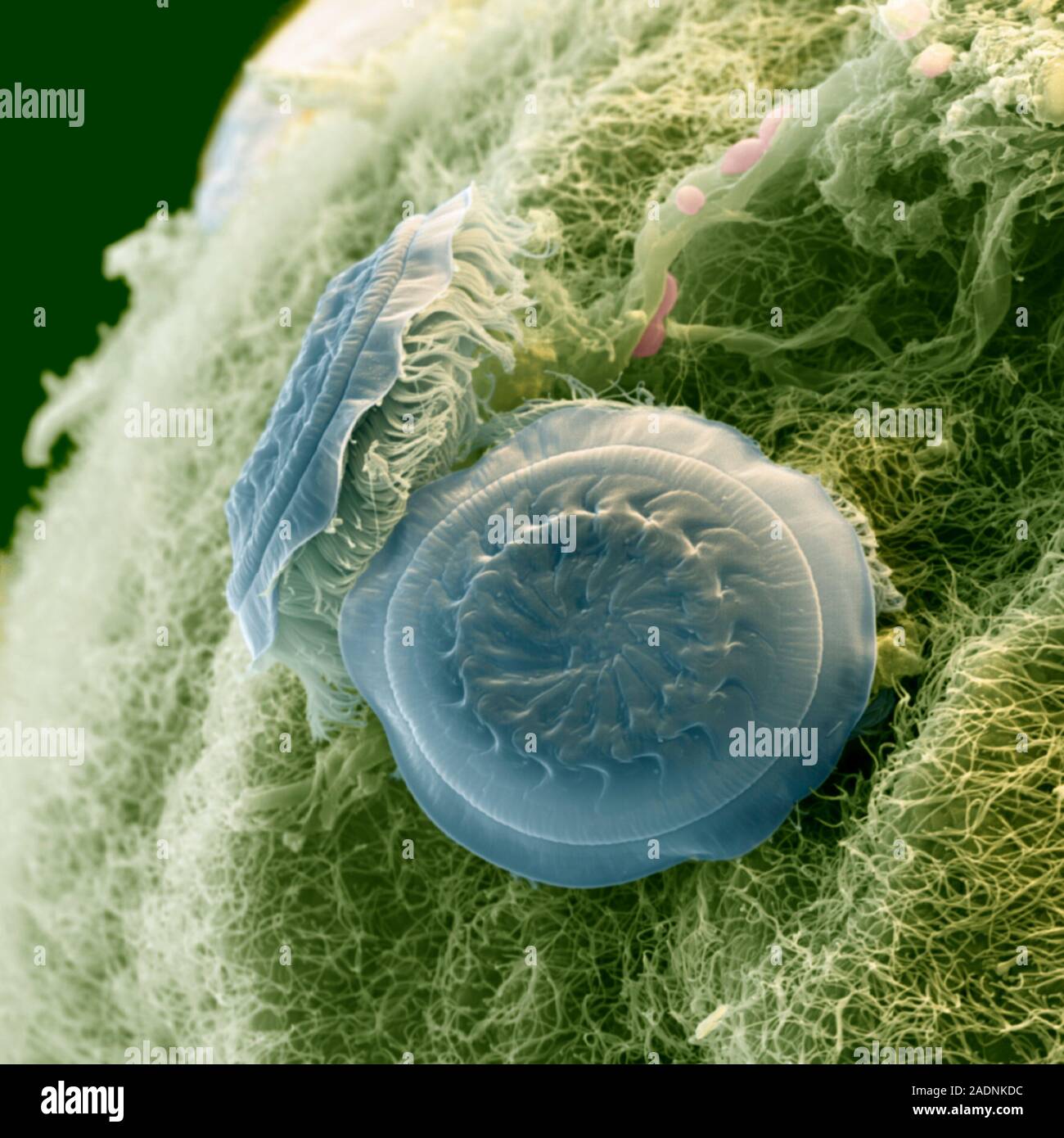 Fish ectoparasite Trichodina sp., coloured scanning electron micrograph