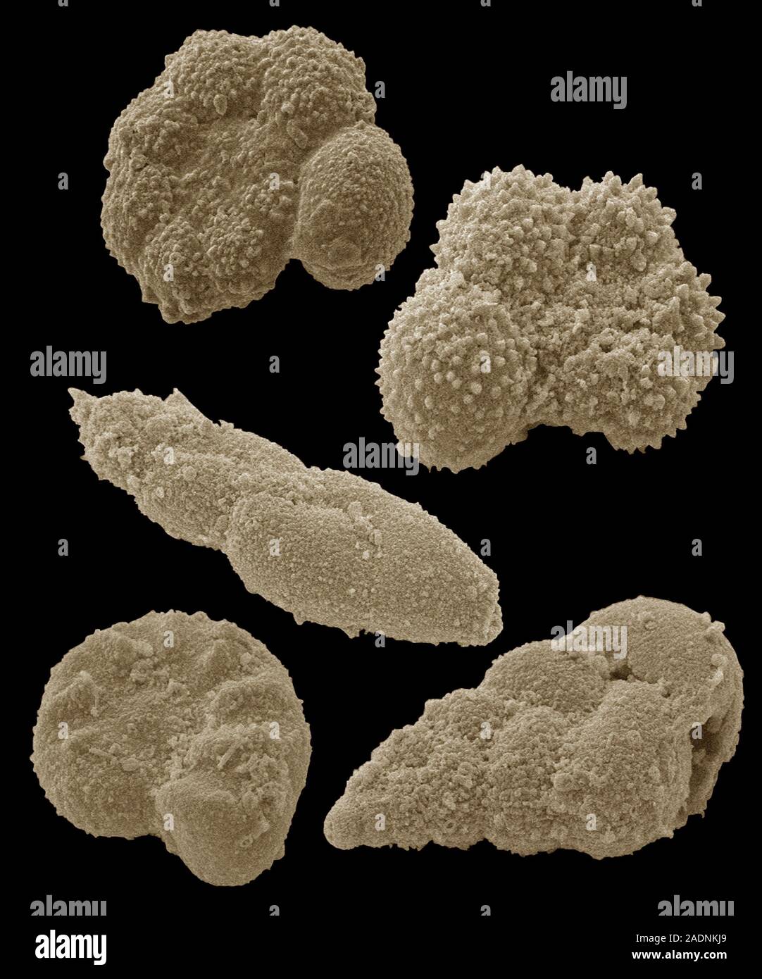 Fossilised foraminiferans. Coloured scanning electron micrograph (SEM ...