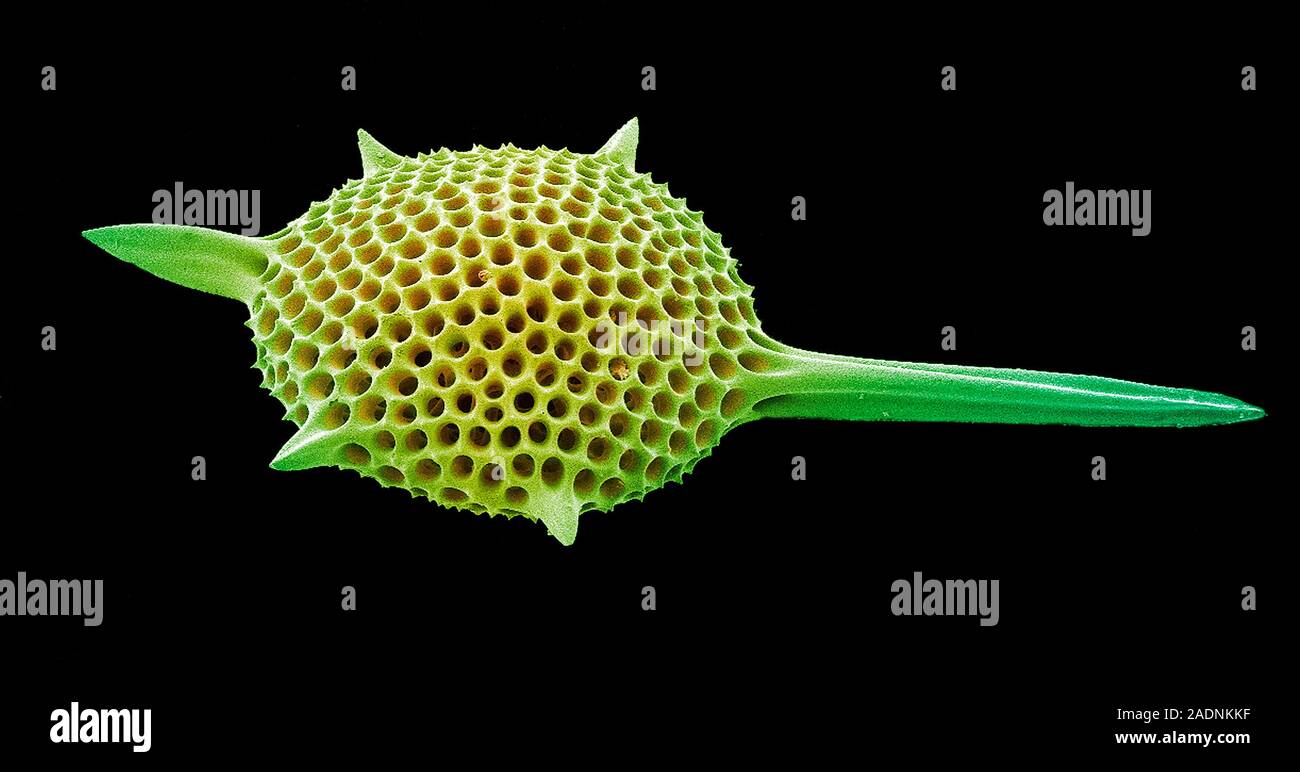 Radiolarian. Coloured scanning electron micrograph (SEM) of the shell