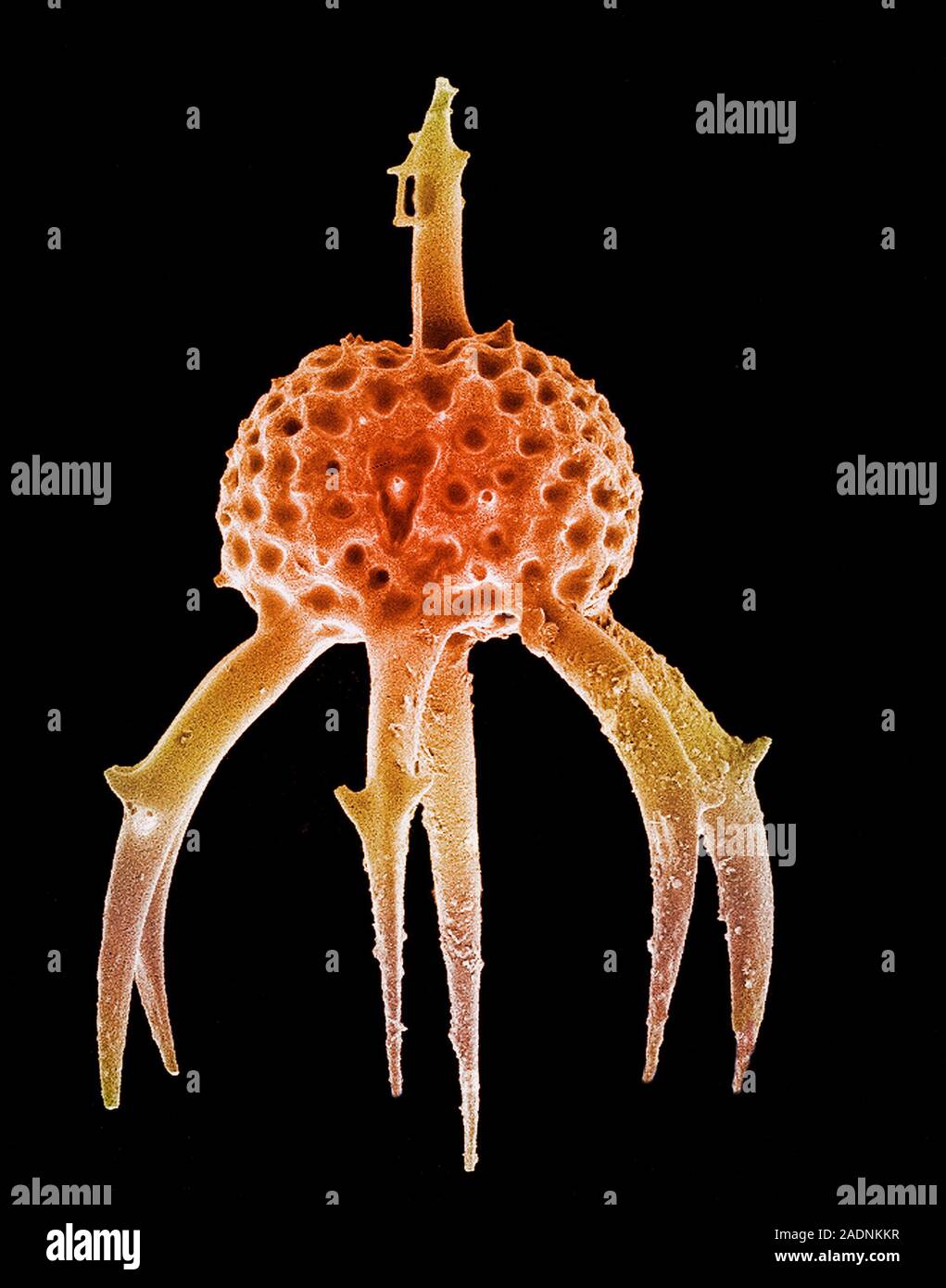 Radiolarian. Coloured scanning electron micrograph (SEM) of the shell