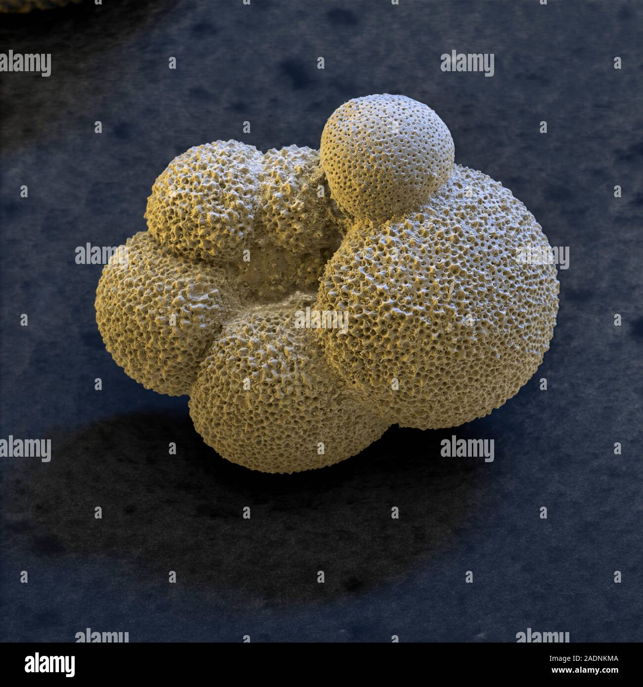 Globigerina foraminiferan. Coloured scanning electron micrograph (SEM ...