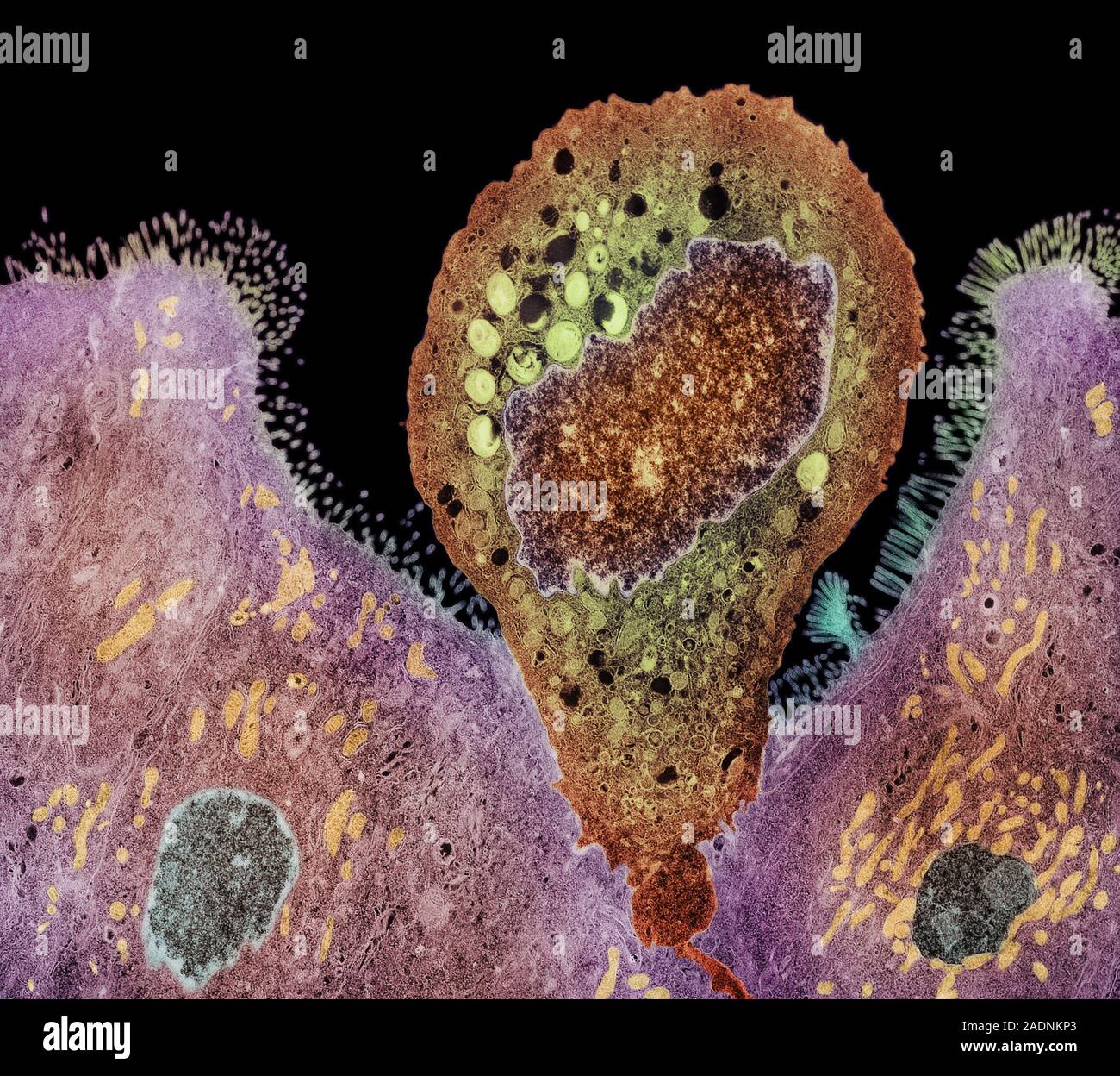 Spore Tem Protozoan spore release. Coloured transmission electron micrograph (TEM ...