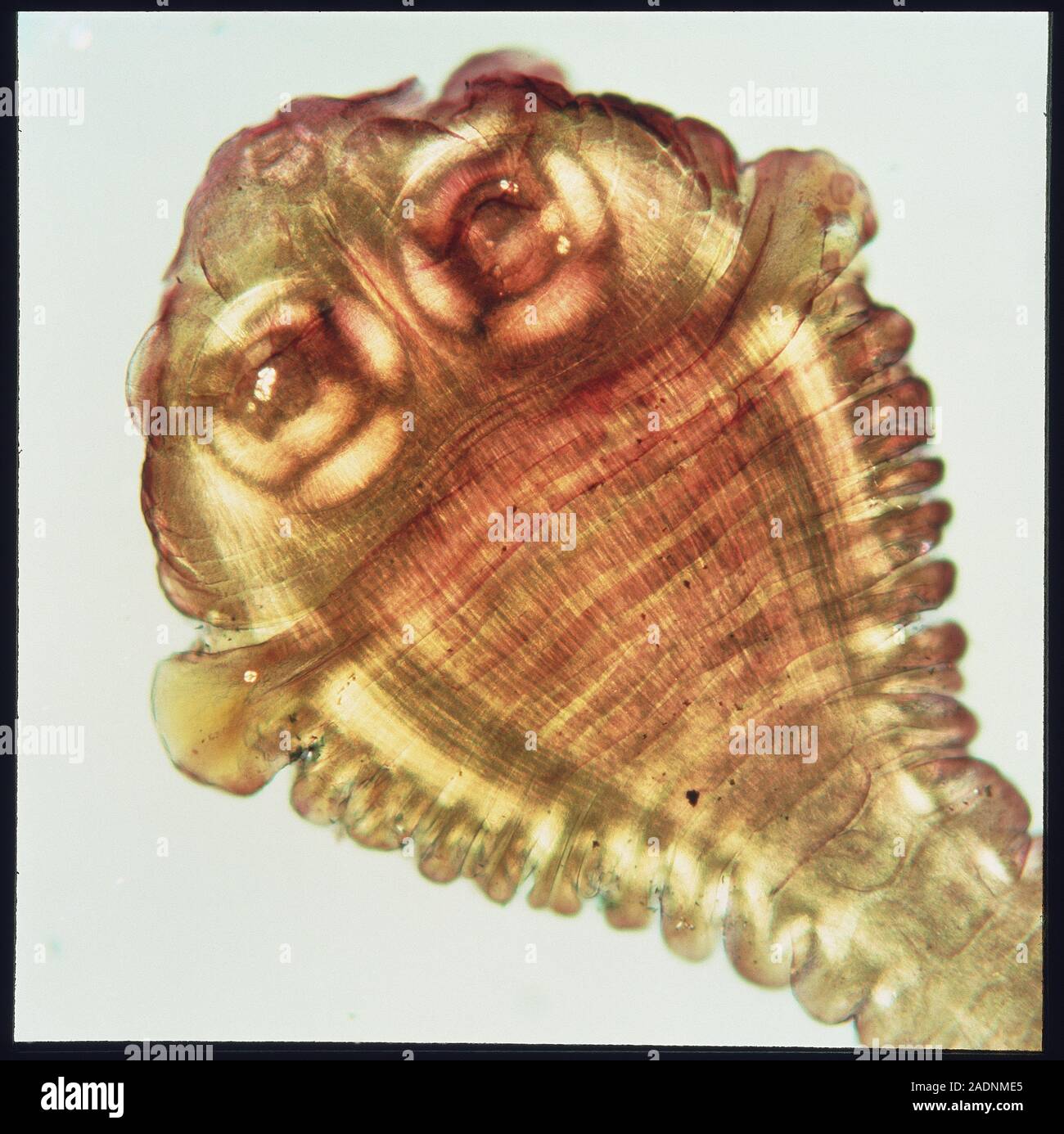 Tapeworm head. Light micrograph of the scolex (head) of the adult beef tapeworm Taenia saginata