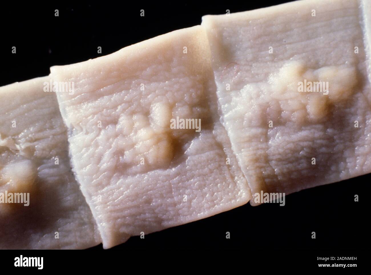 Tapeworm parasite. Sections (proglottids) of the broad fish tapeworm