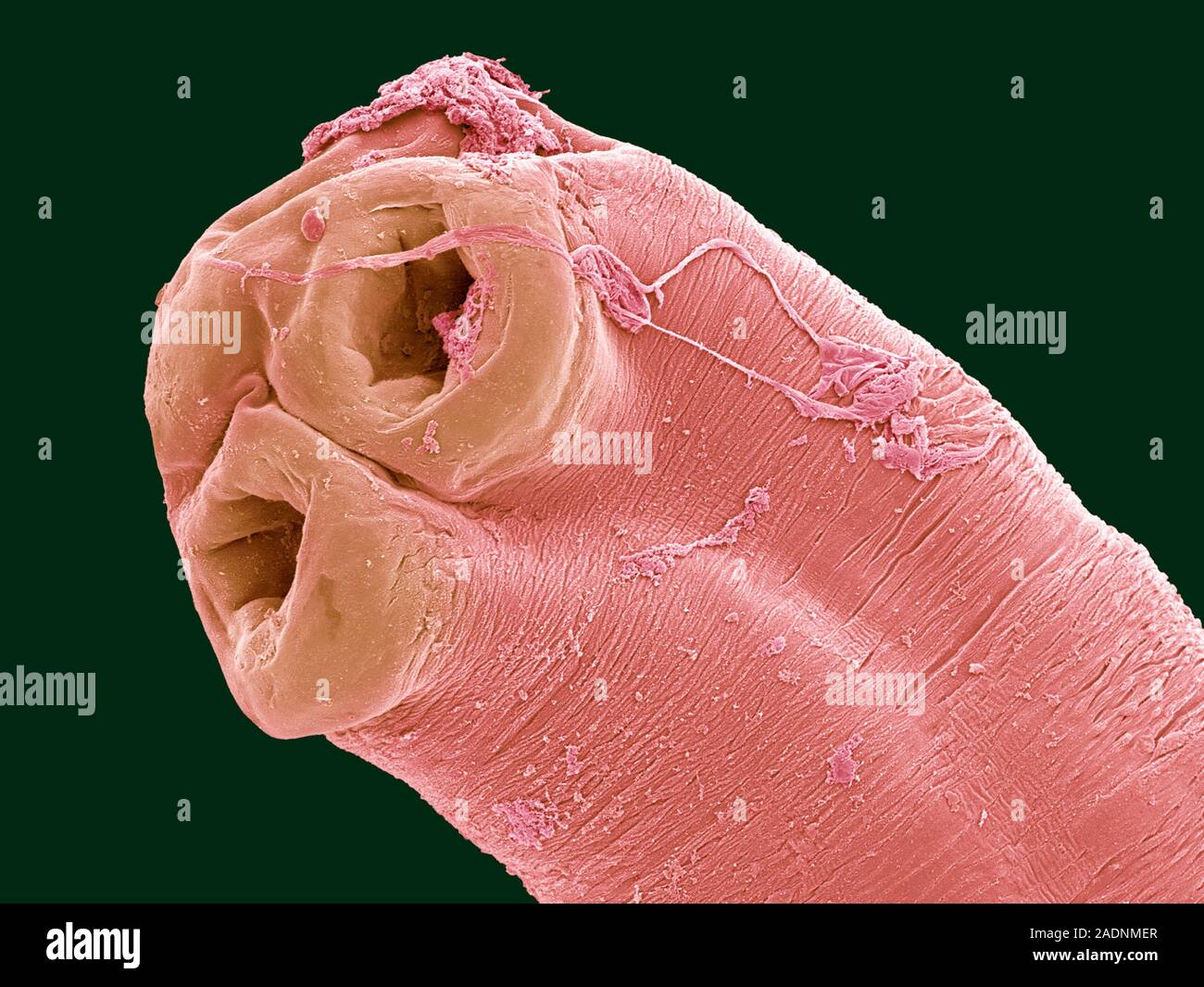 Cobra Tapeworm Coloured Scanning Electron Micrograph Sem Of The Head Scolex Of A Cobra