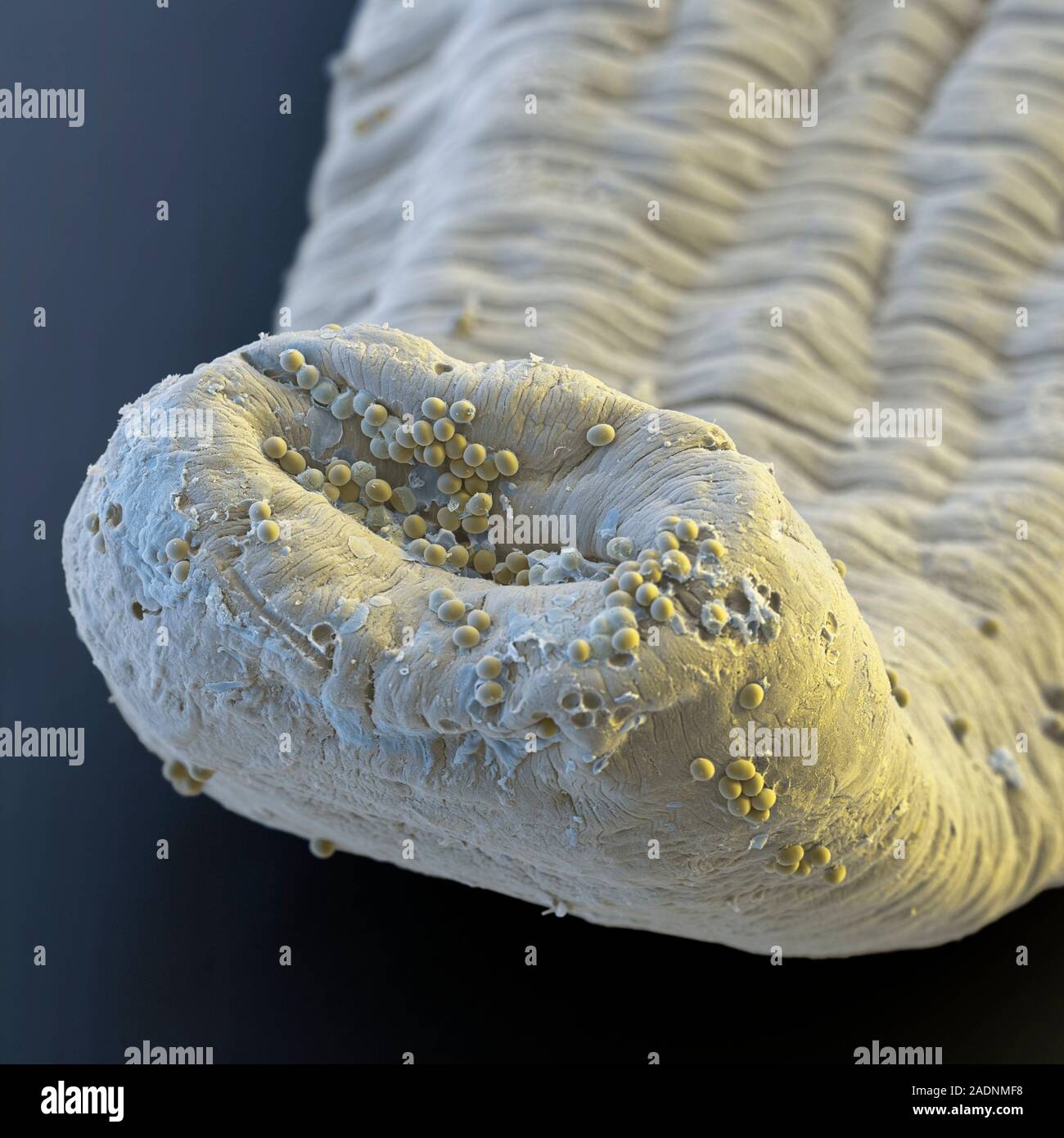 Dog tapeworm (Echinococcus granulosus) with eggs, coloured scanning