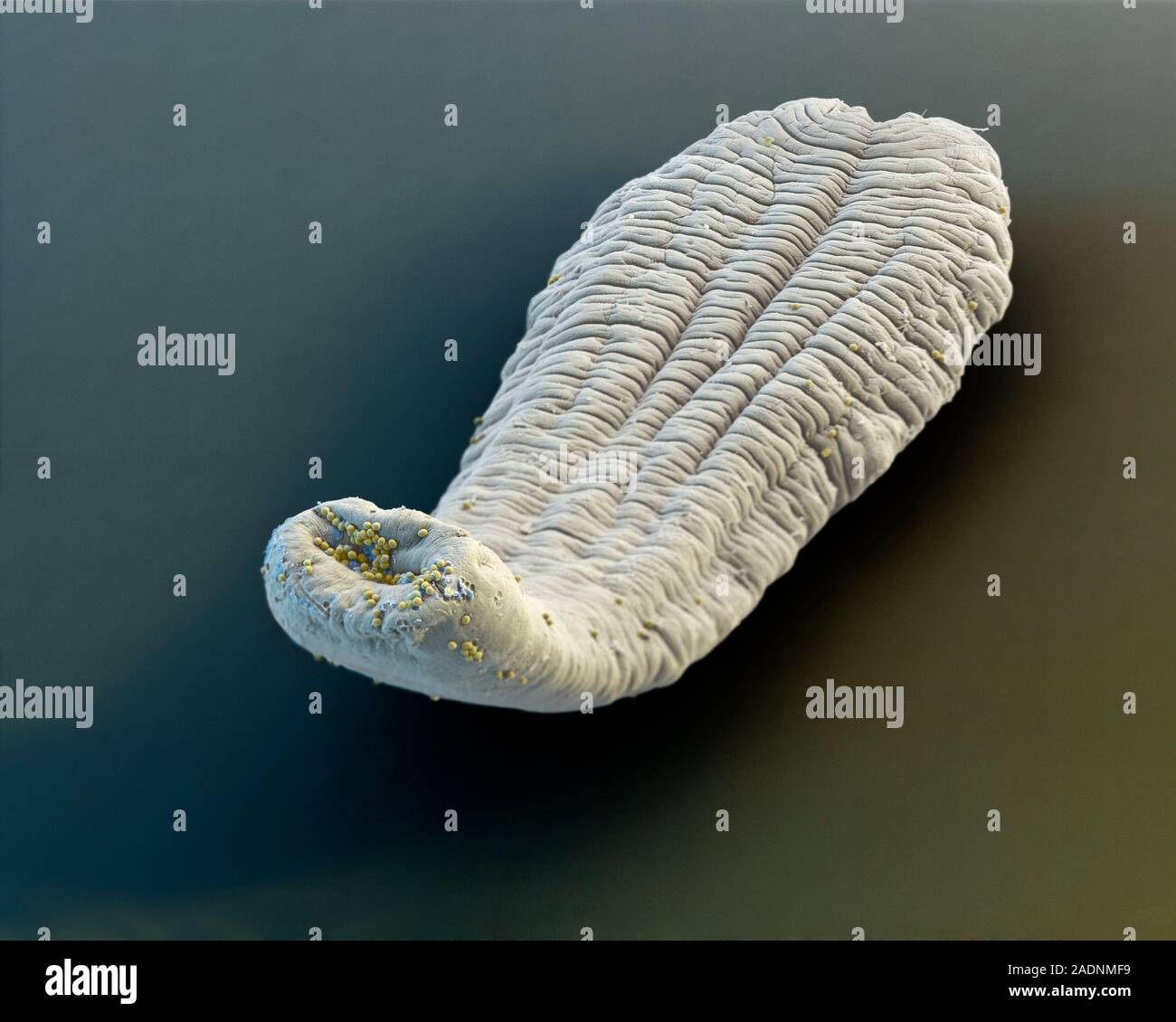 Dog tapeworm (Echinococcus granulosus) with eggs, coloured scanning