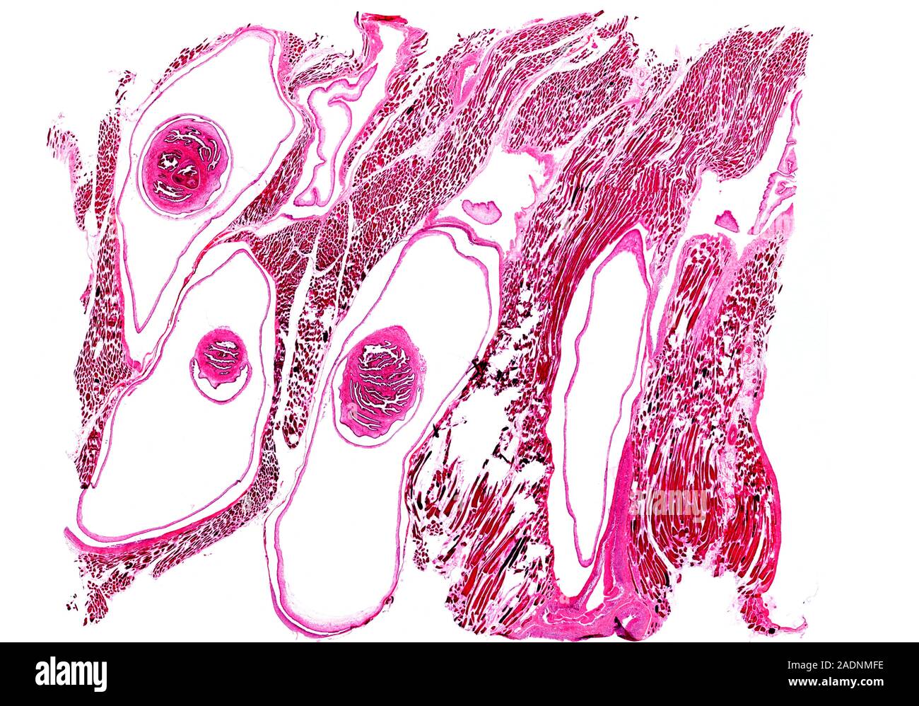 Tapeworminfected pork. Light micrograph of a section through pork infected by the pork tapeworm