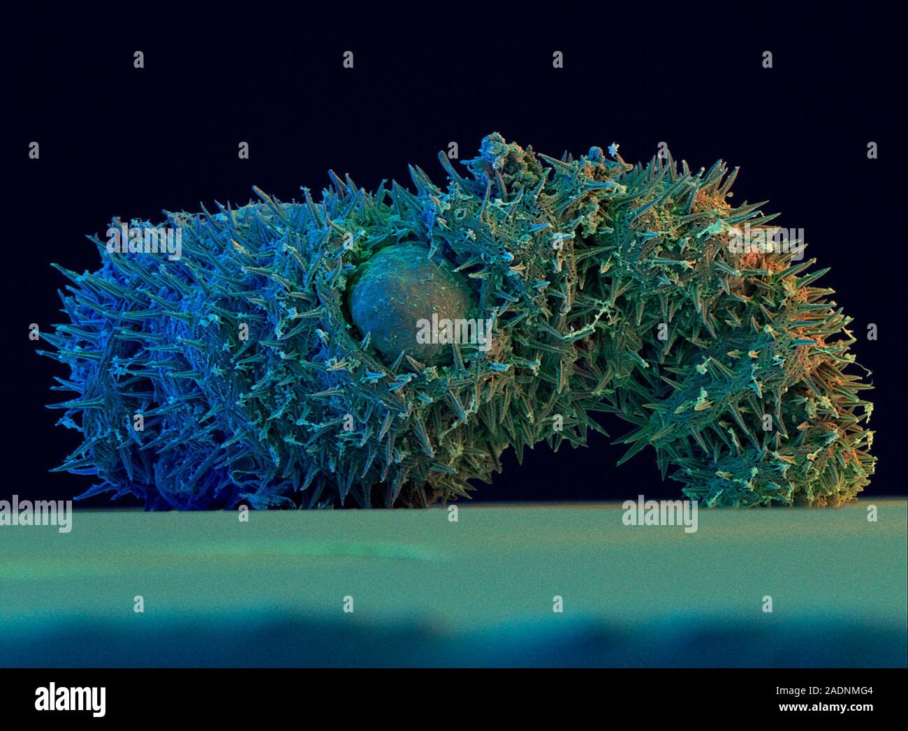 Acanthodasys. Coloured Scanning Electron Micro- graph (SEM) of the ...