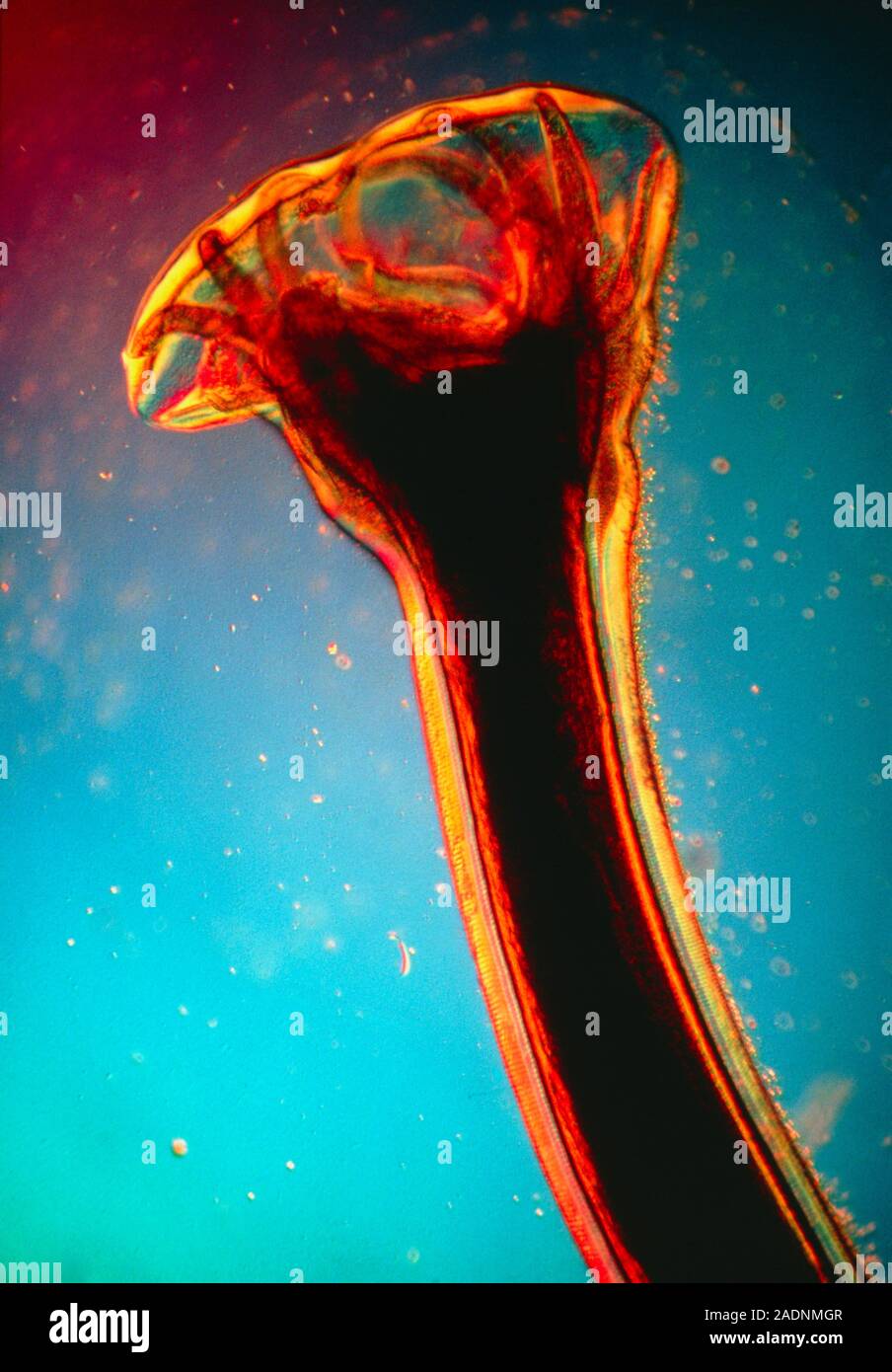 Hookworm parasite. Light micrograph of the rear end of Ancylostoma