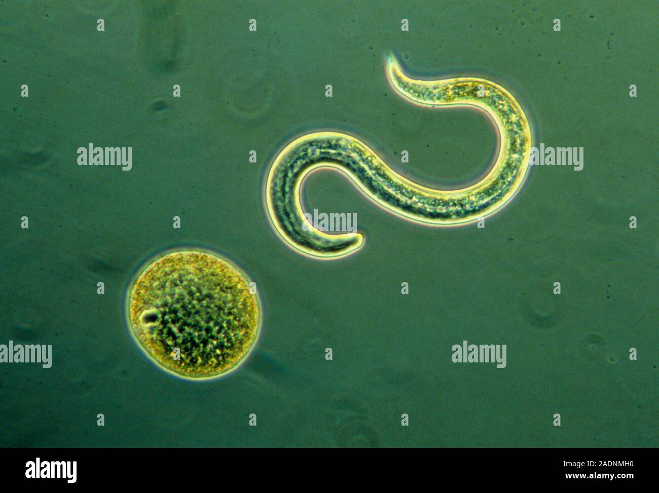 Токсокароз у взрослых что это. Токсокароз у взрослых клинические рекомендации. Схема жизненного цикла токсокары. Токсокароз у взрослых что это. Токсокара взрослая особь.