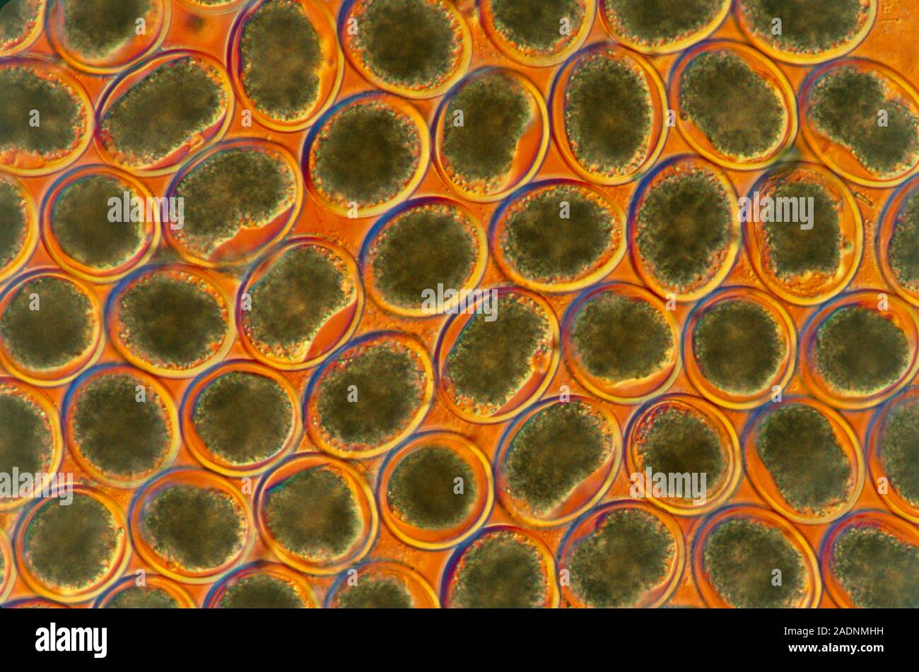 Light micrograph of the eggs of the dog and cat roundworm Toxascaris leonina. Infection with