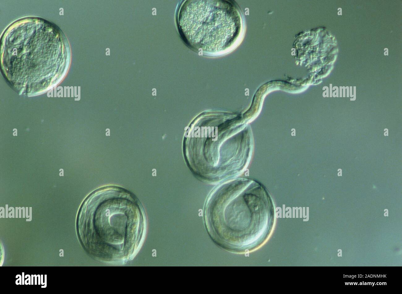 Light micrograph of eggs and hatching larva of the dog and cat roundworm Toxascaris leonina