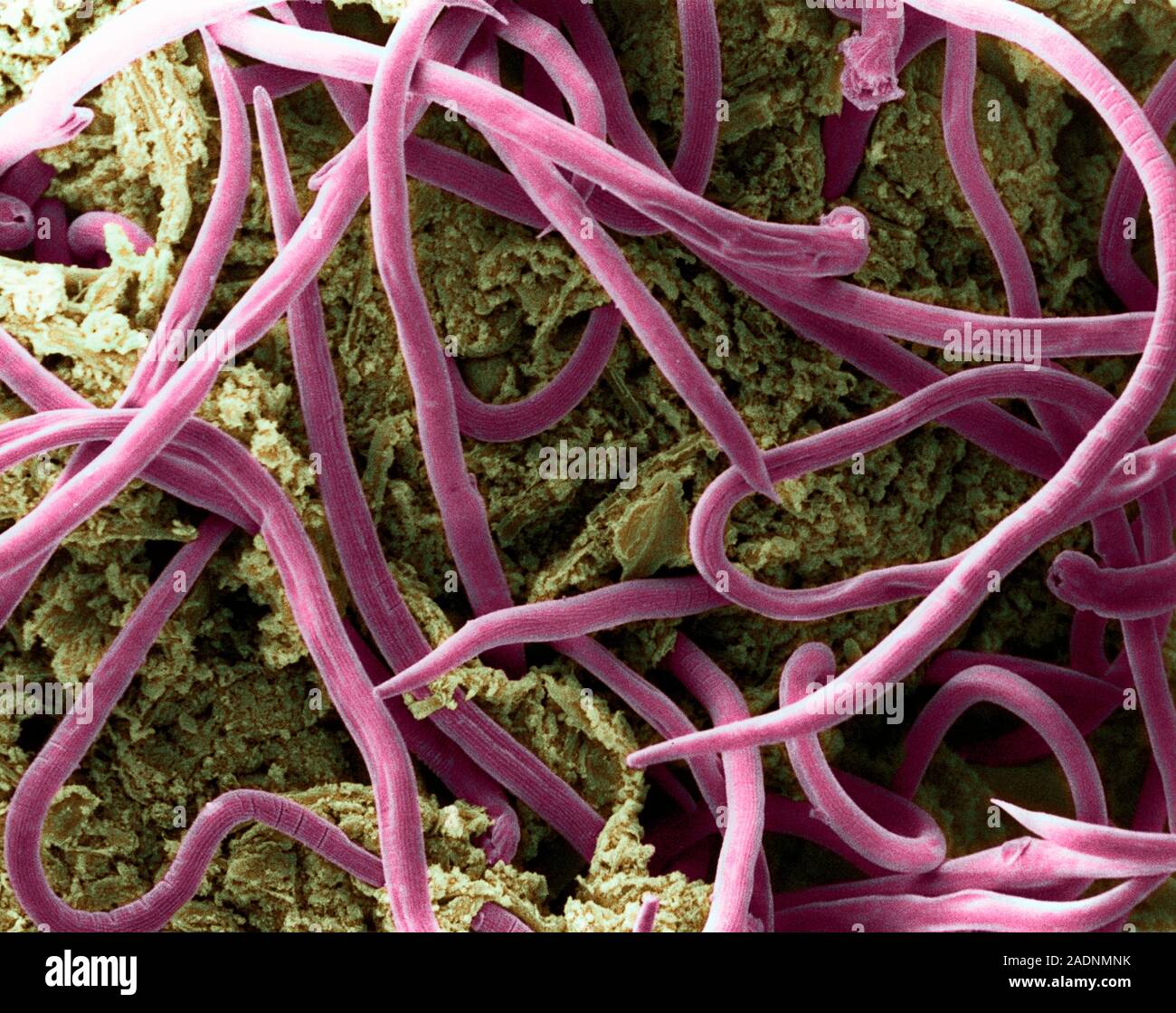 Threadworms in intestine. Coloured scanning electron micrograph (SEM