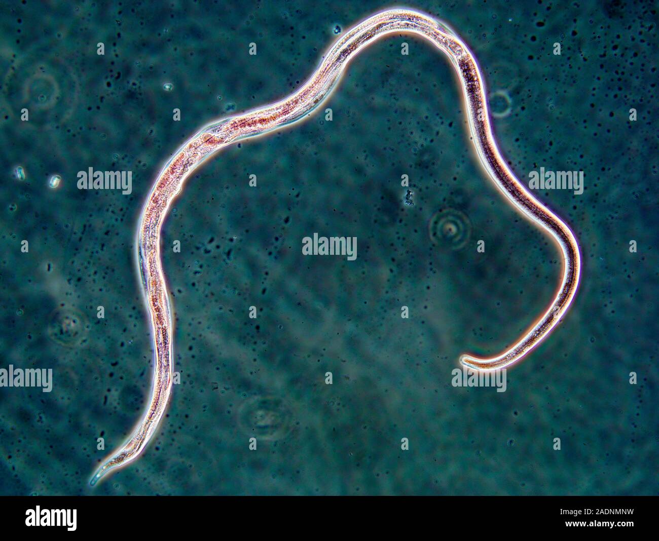 Nematode worm. Coloured light micrograph (LM) of a female nematode worm
