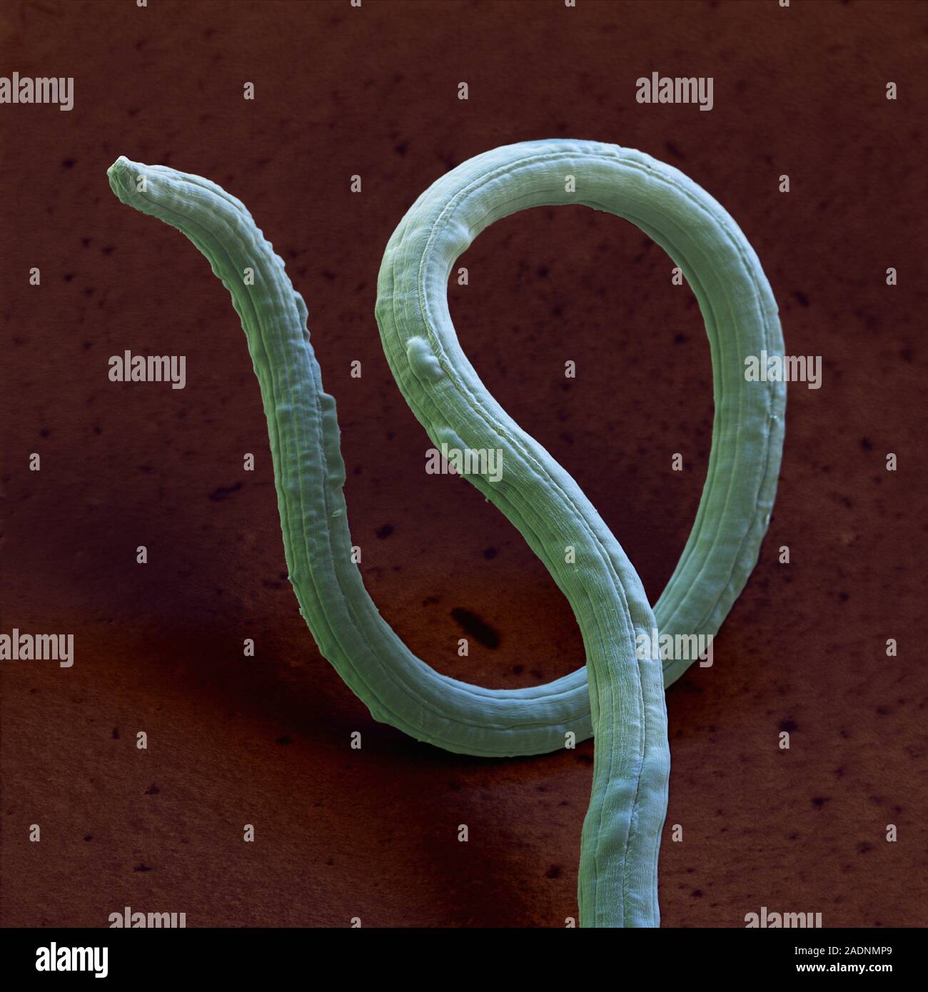 Dog lungworm (Angiostrongylus vasorum) adult, coloured scanning