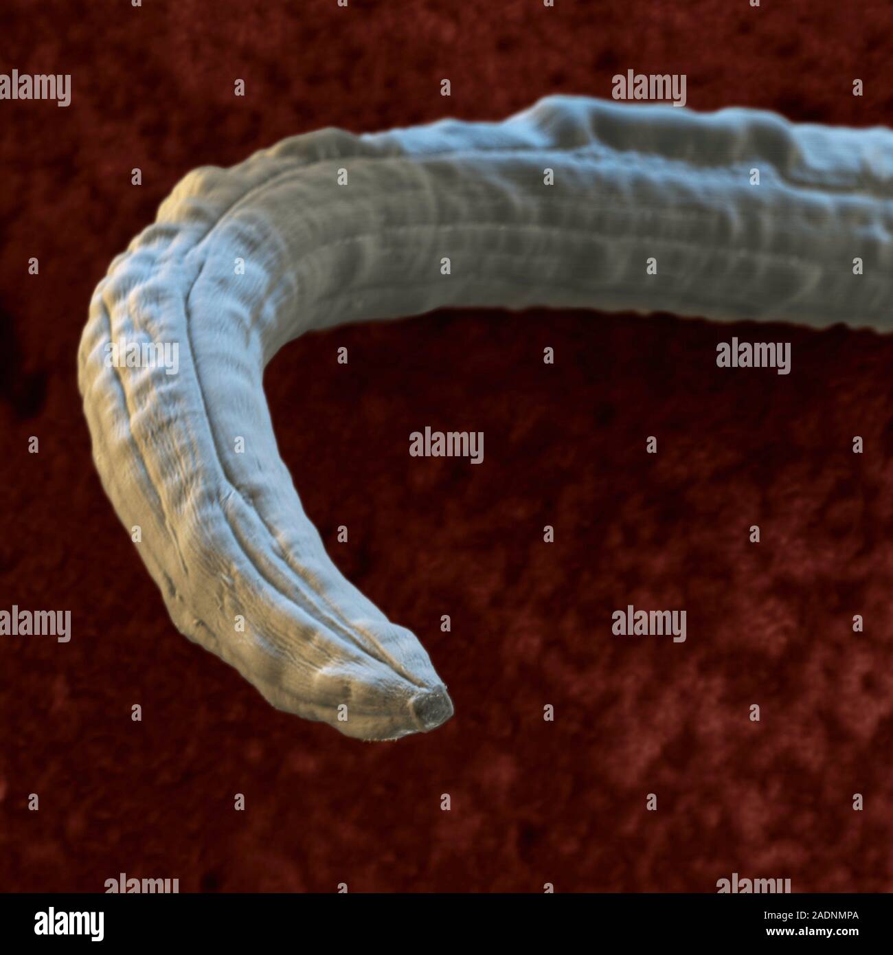 Dog lungworm (Angiostrongylus vasorum) adult, coloured scanning